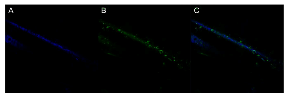 Biosensors 02 00465 g005