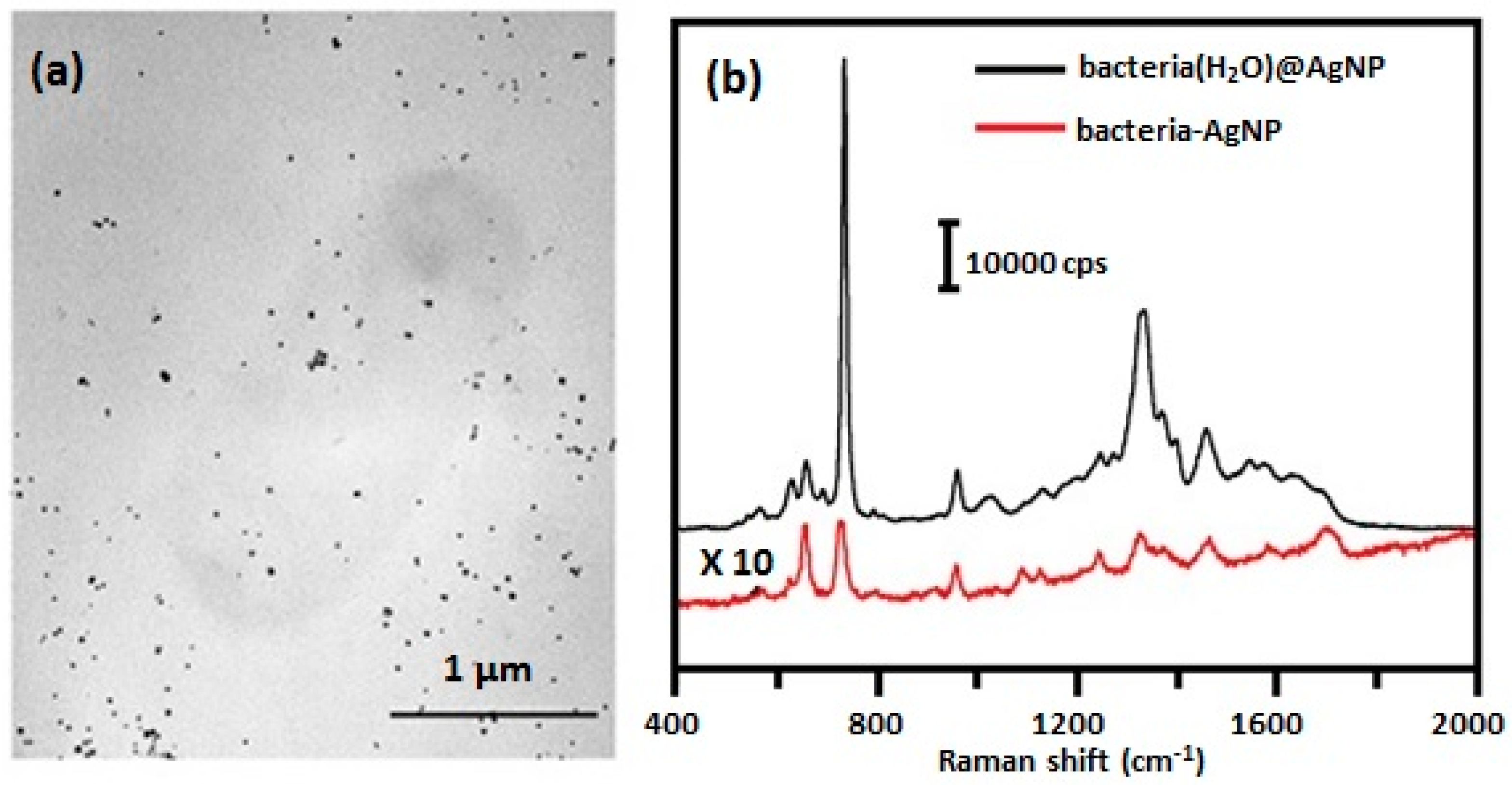 Biosensors 07 00051 g010 Biosensors 07 00051 g010