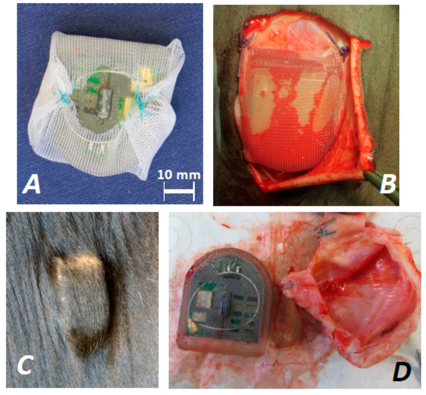Biosensors 08 00013 g002