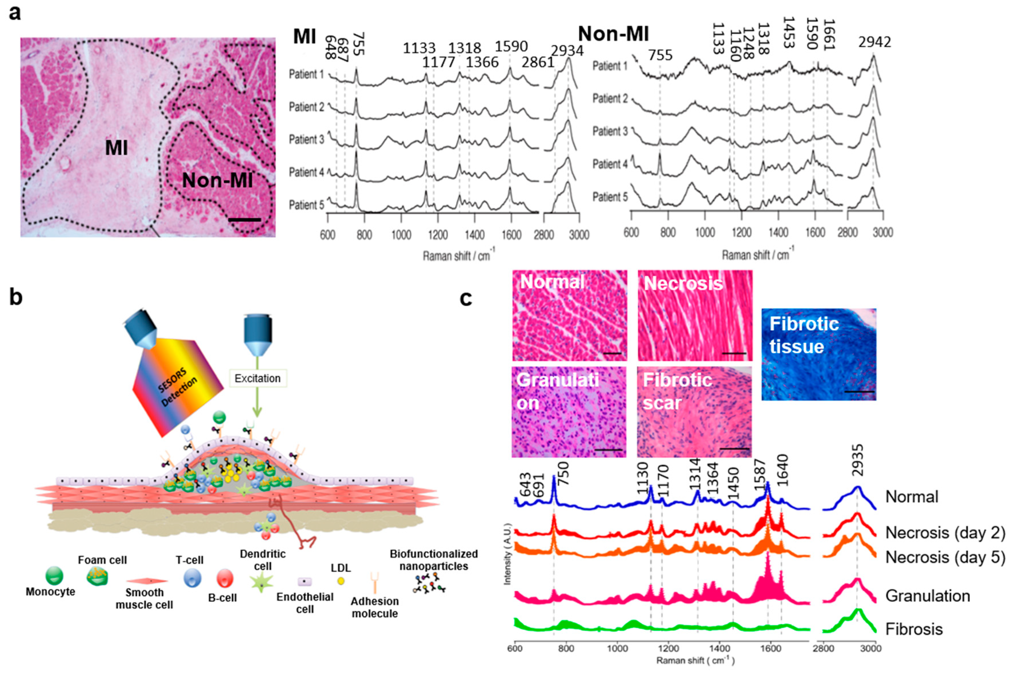 Biosensors 08 00107 g008