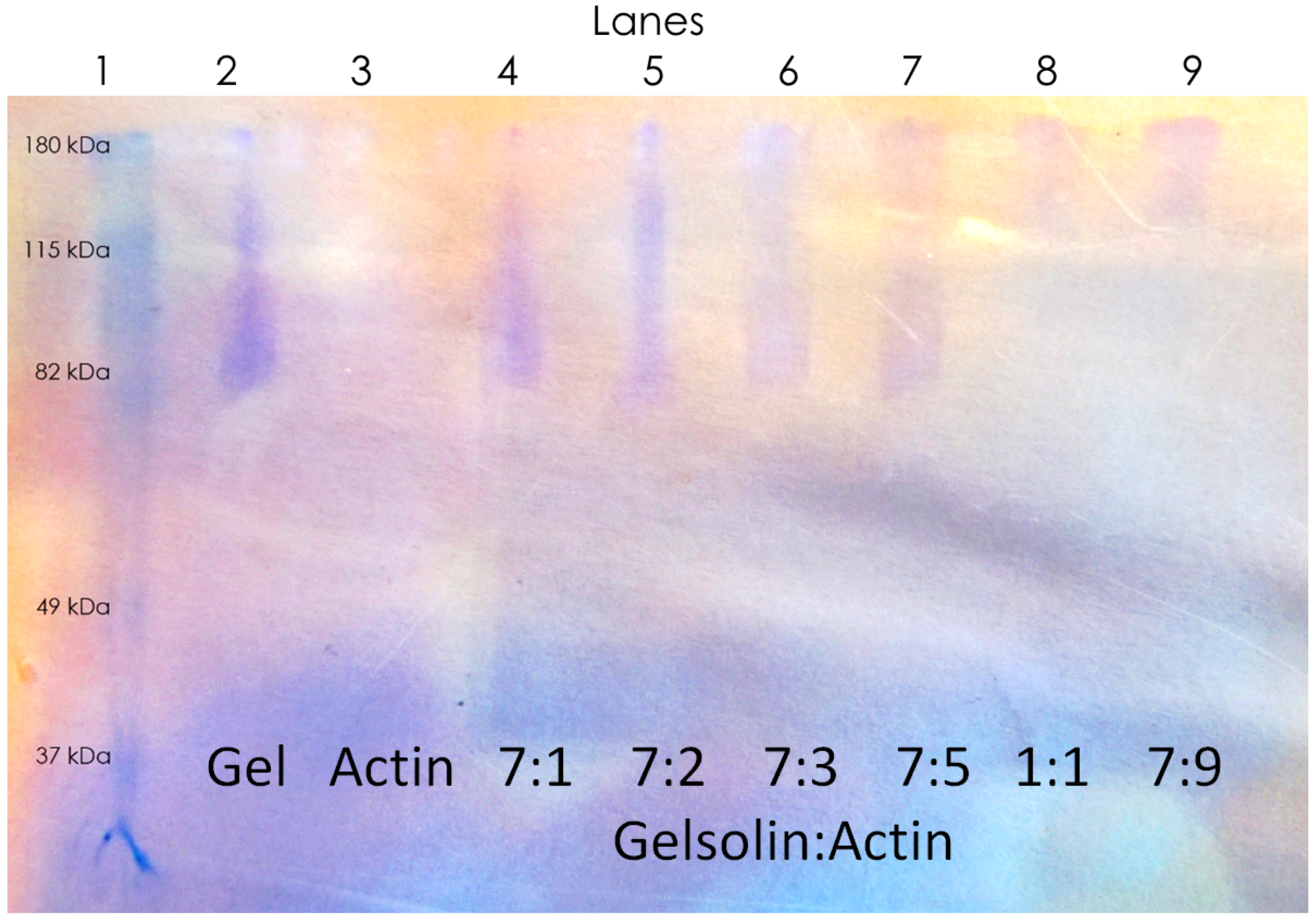 Biosensors 10 00013 g003 Biosensors 10 00013 g003