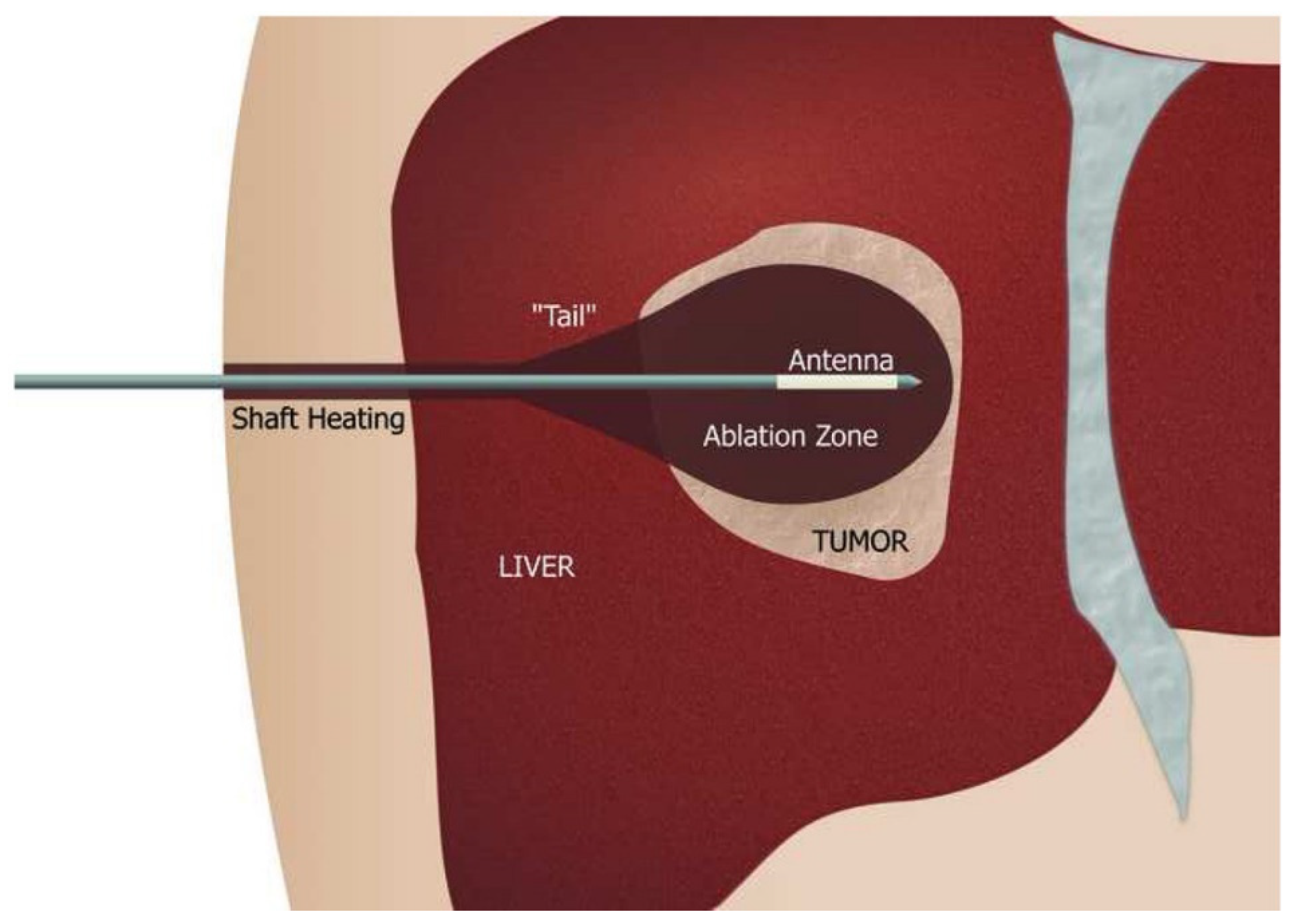 Biosensors 11 00096 g005 Biosensors 11 00096 g005