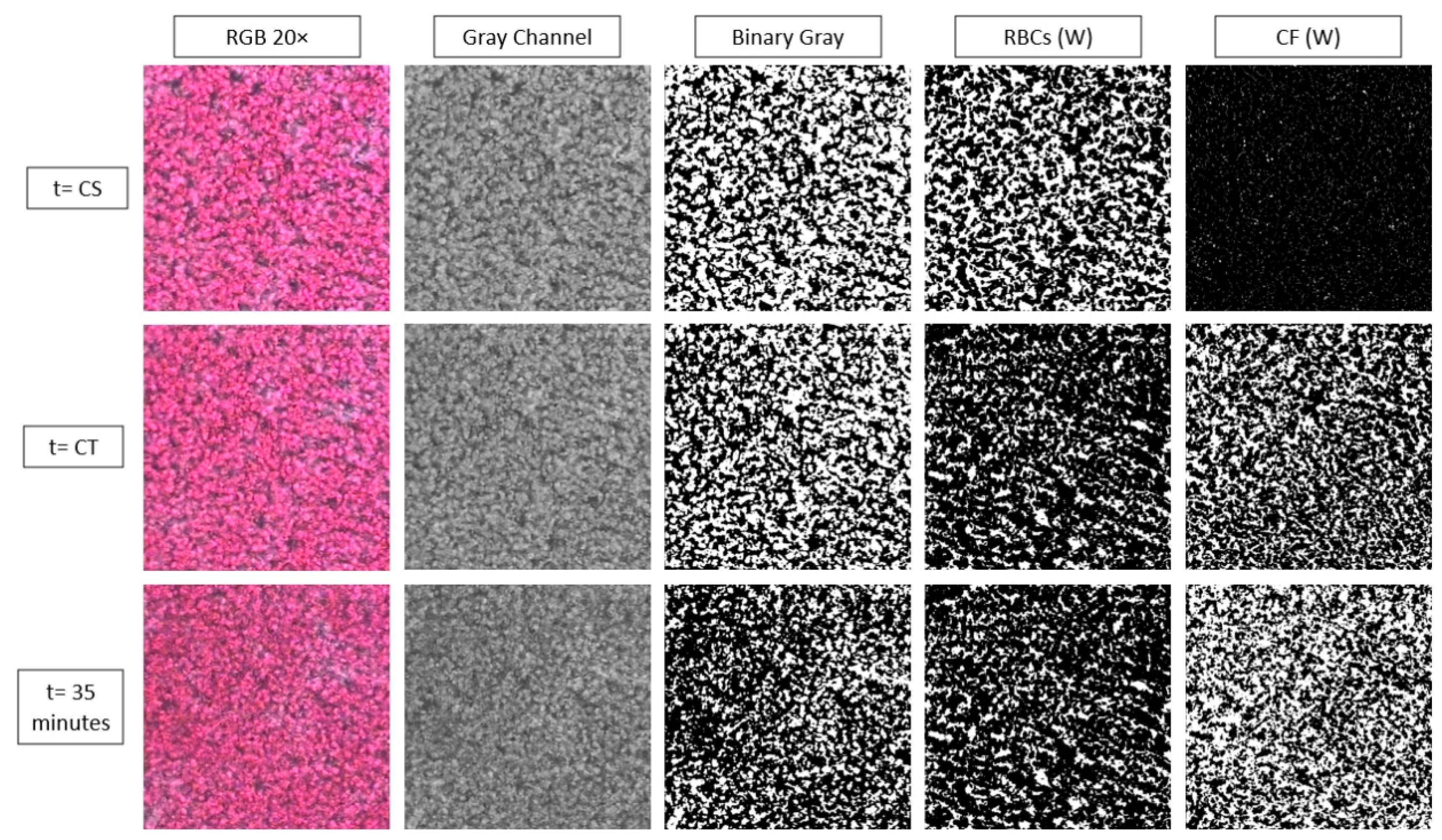 Biosensors 11 00113 g004