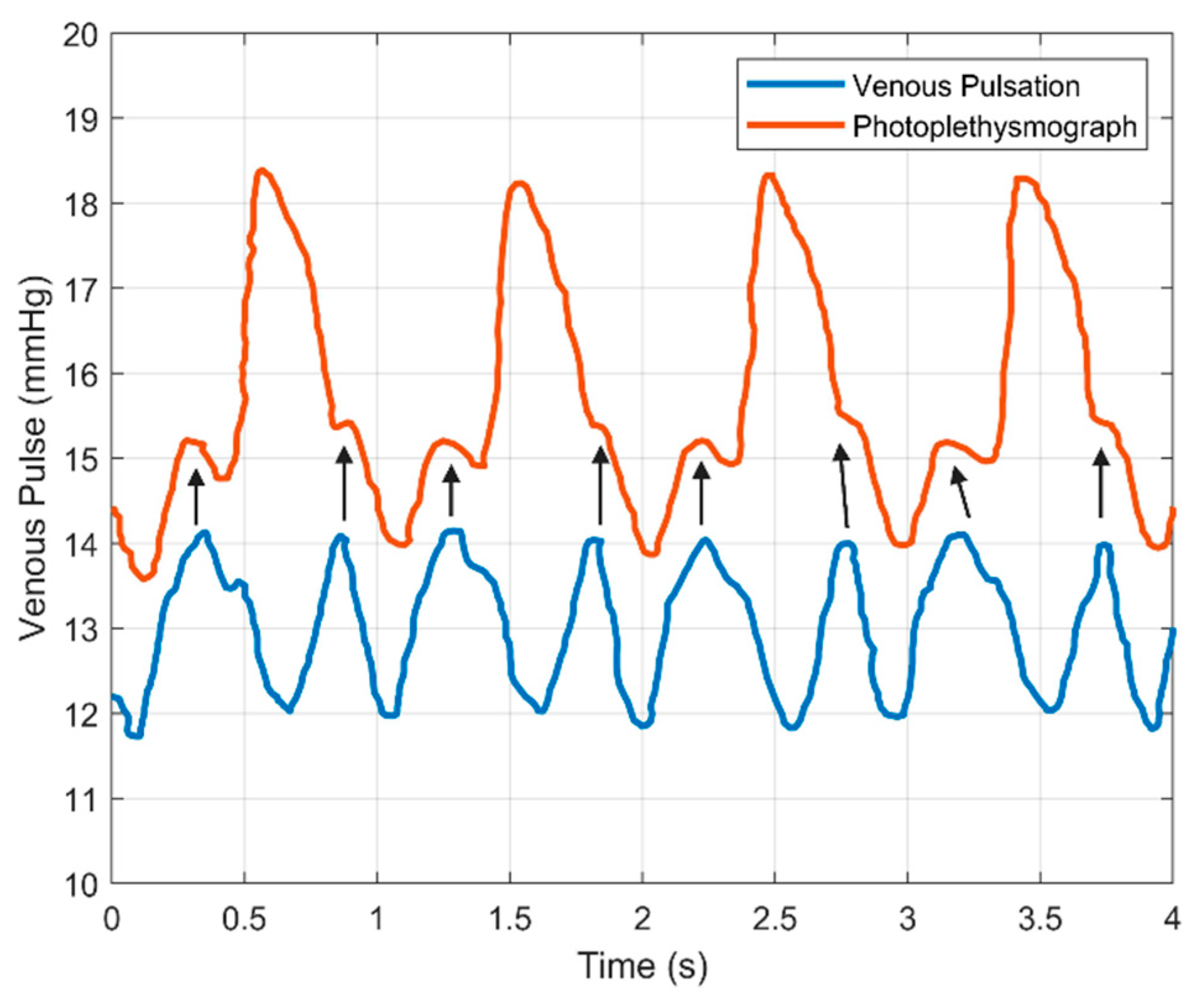 Biosensors 11 00126 g006