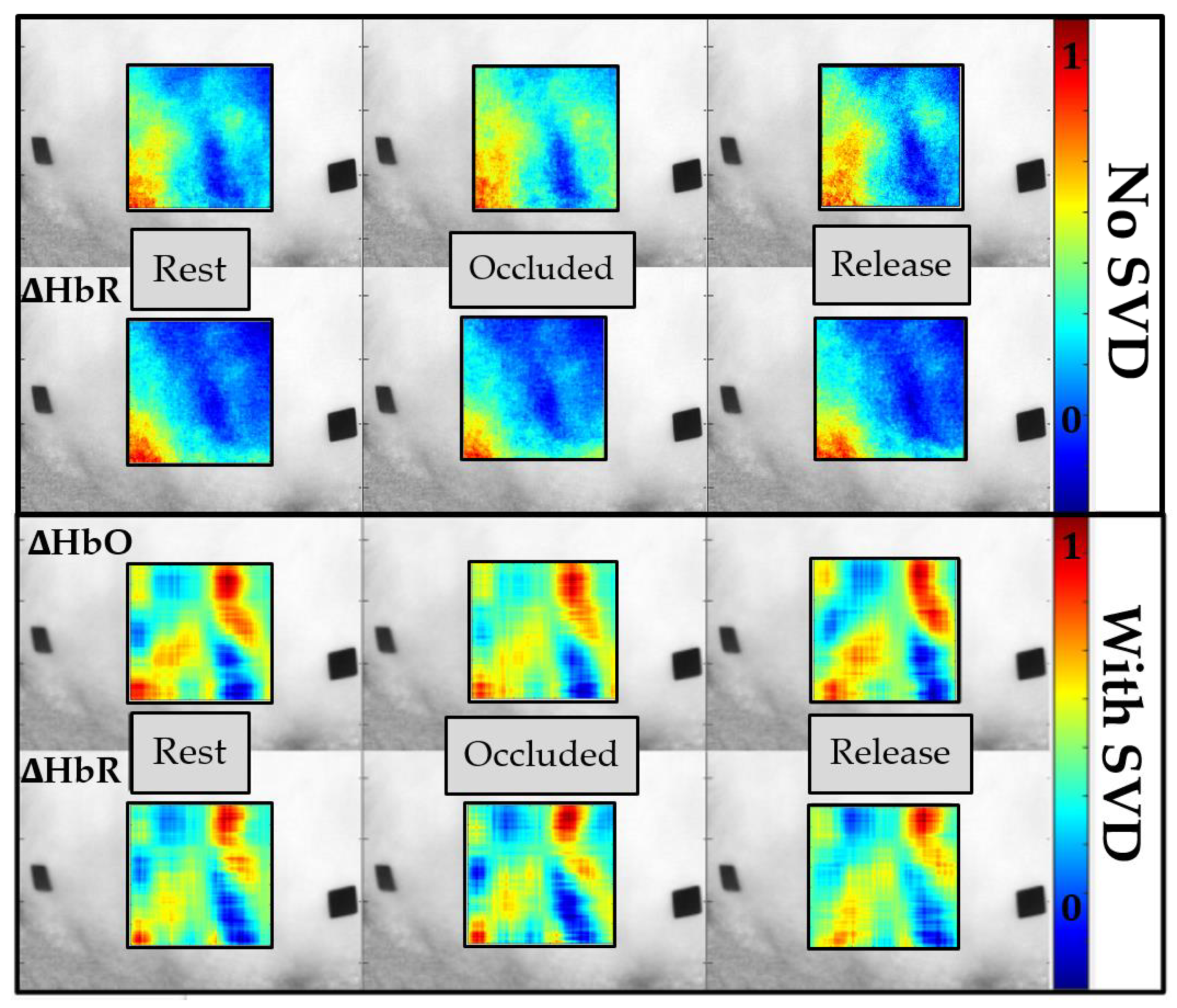 Biosensors 11 00165 g010