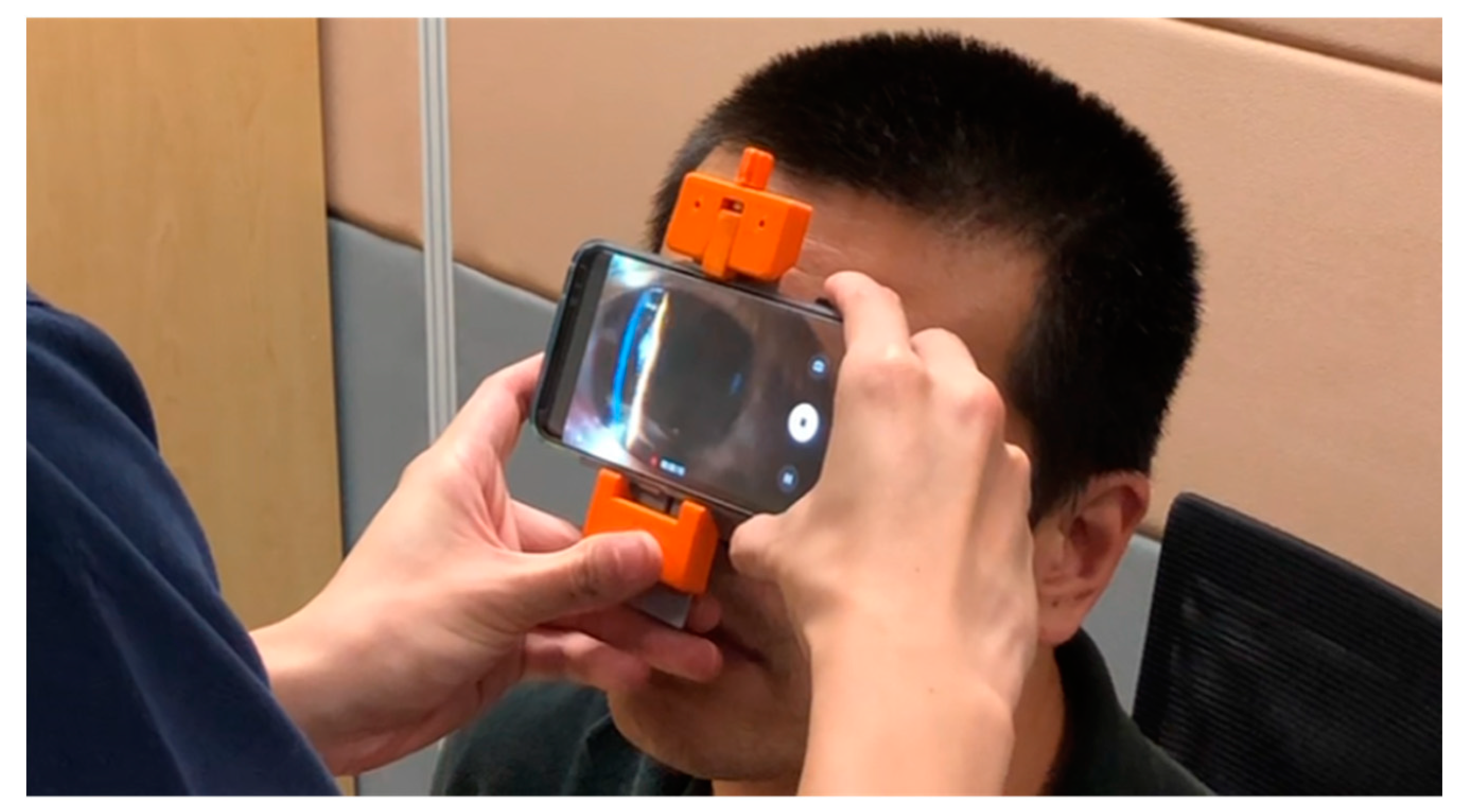 Biosensors 11 00182 g001 Biosensors 11 00182 g001