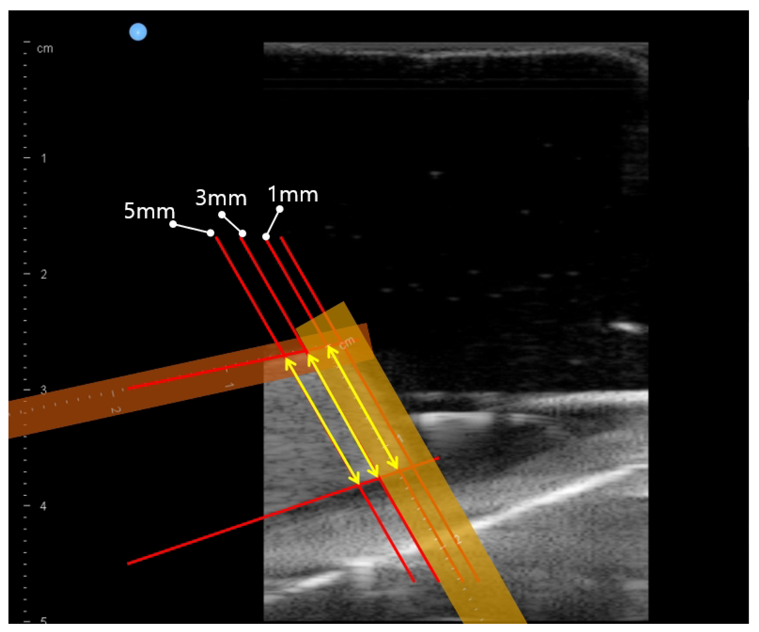 Biosensors 11 00243 g011 550