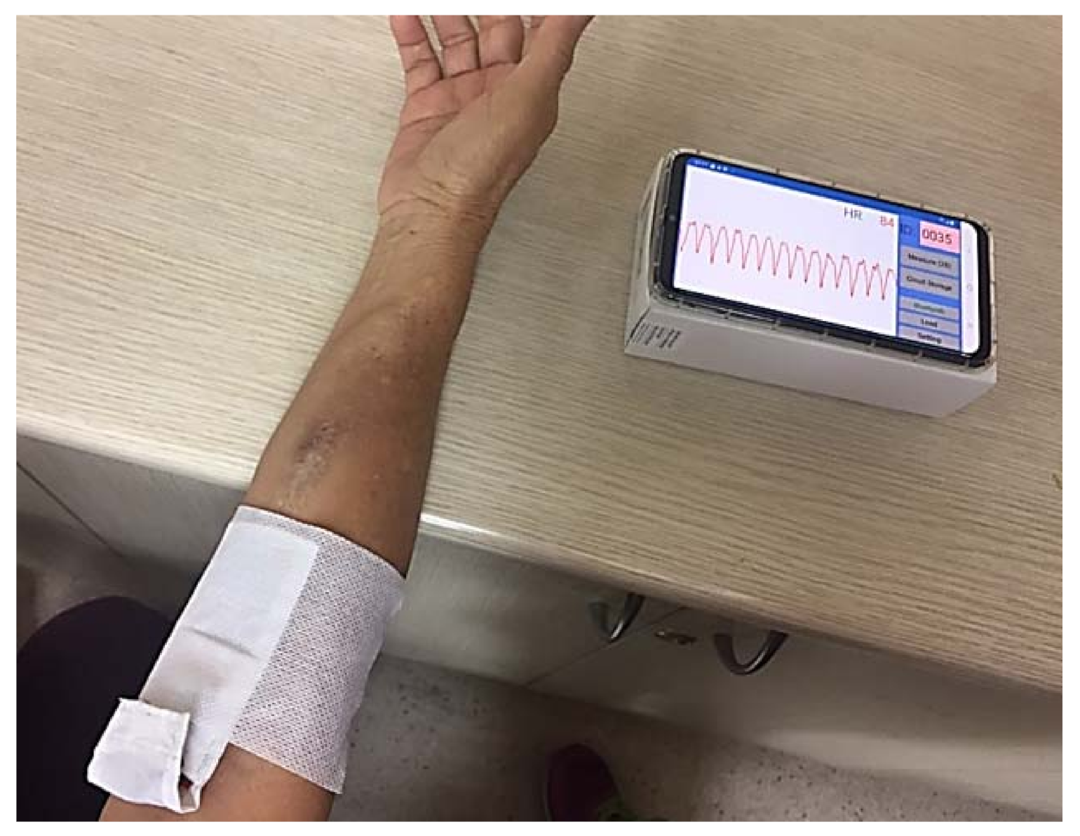 Biosensors 11 00297 g003 550