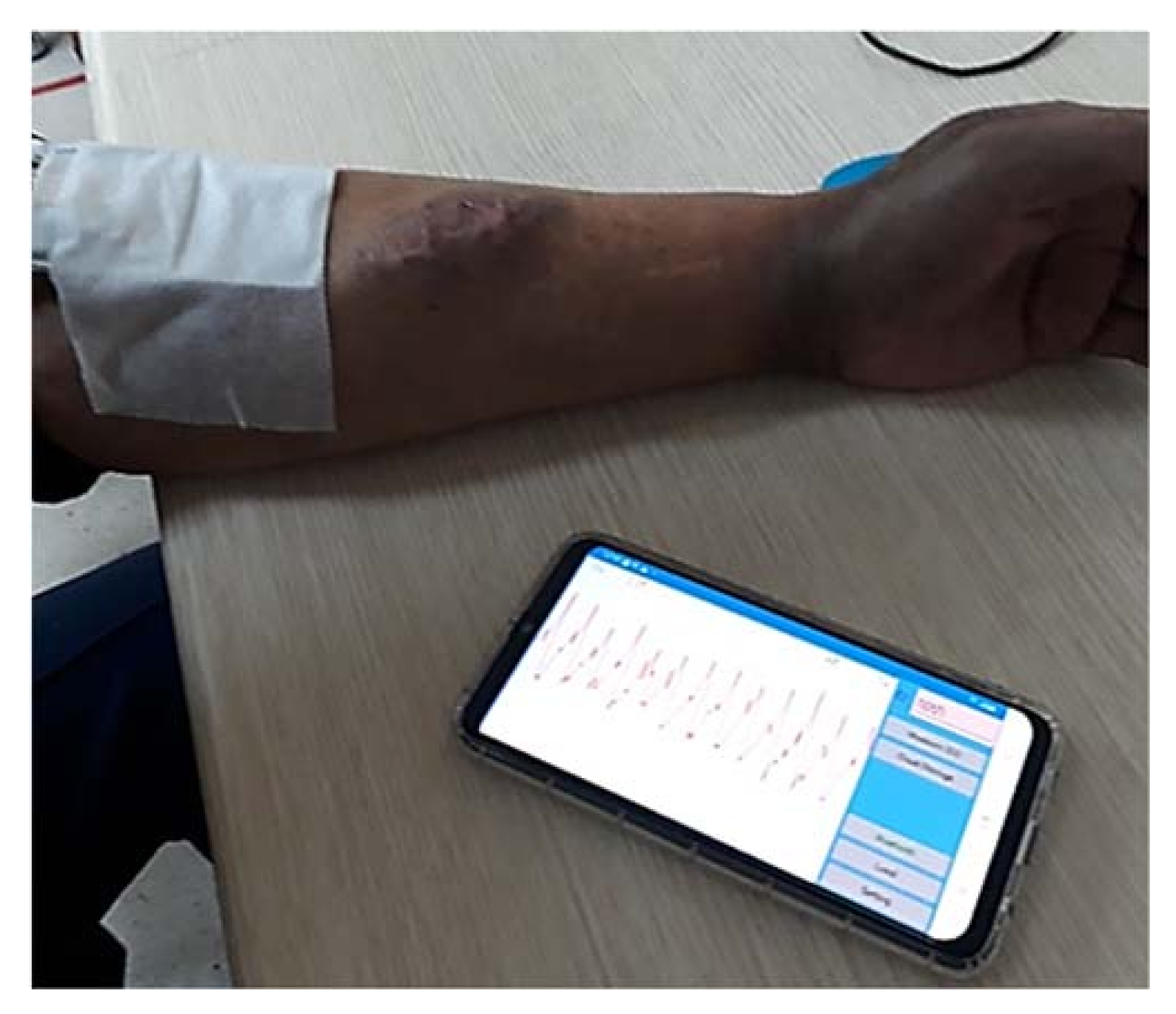 Biosensors 11 00297 g0a1 550