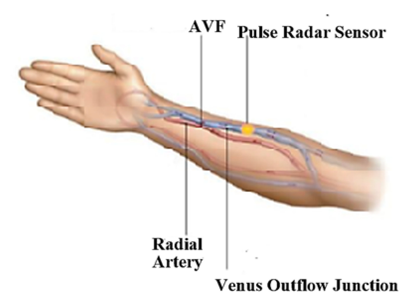 Biosensors 11 00297 g0a3 550