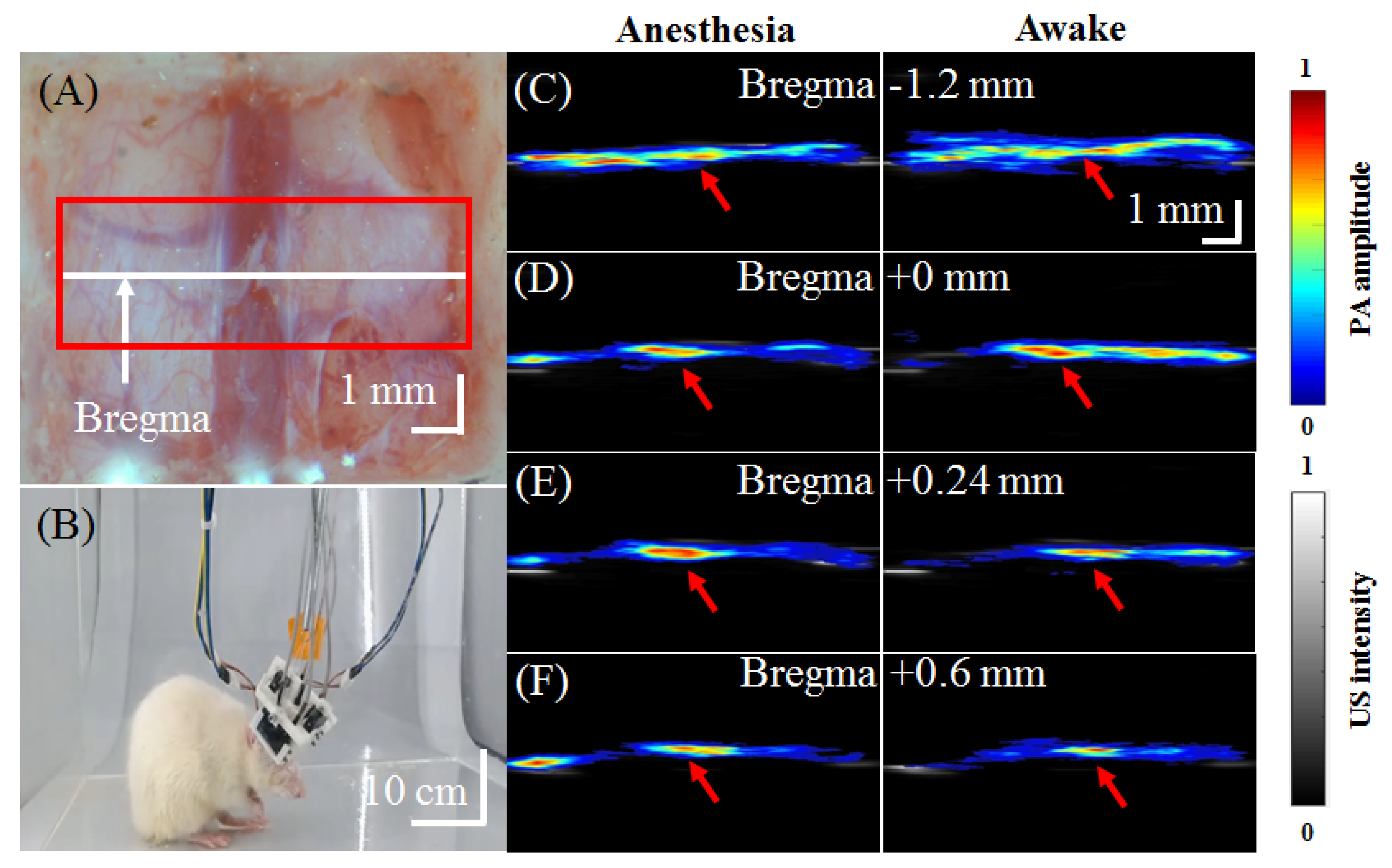 Biosensors 11 00429 g010