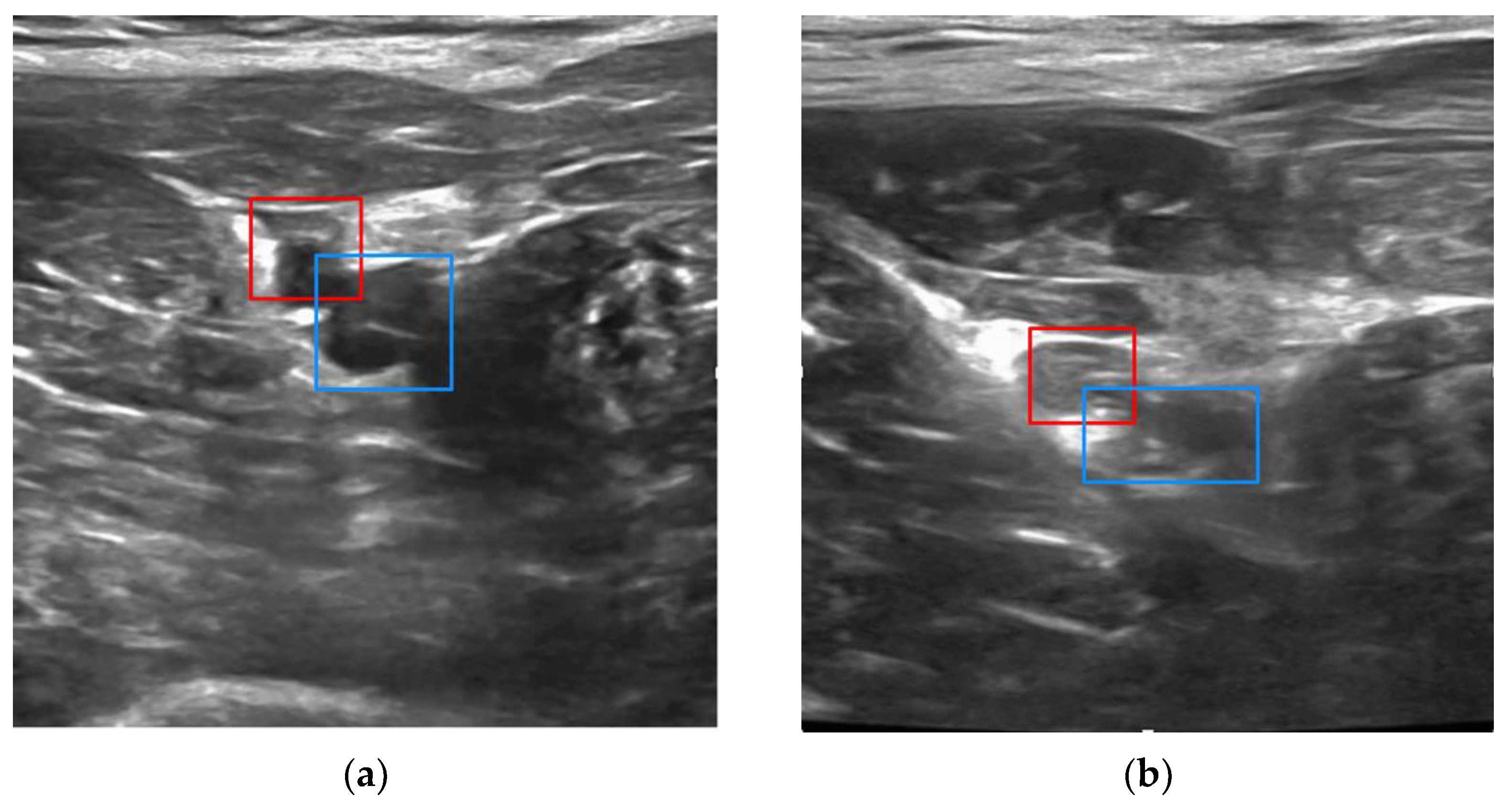 Biosensors 11 00522 g006