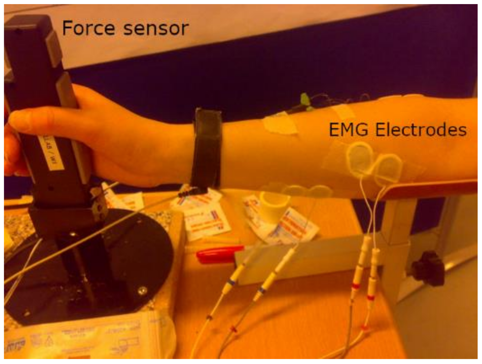 Biosensors 12 00117 g005