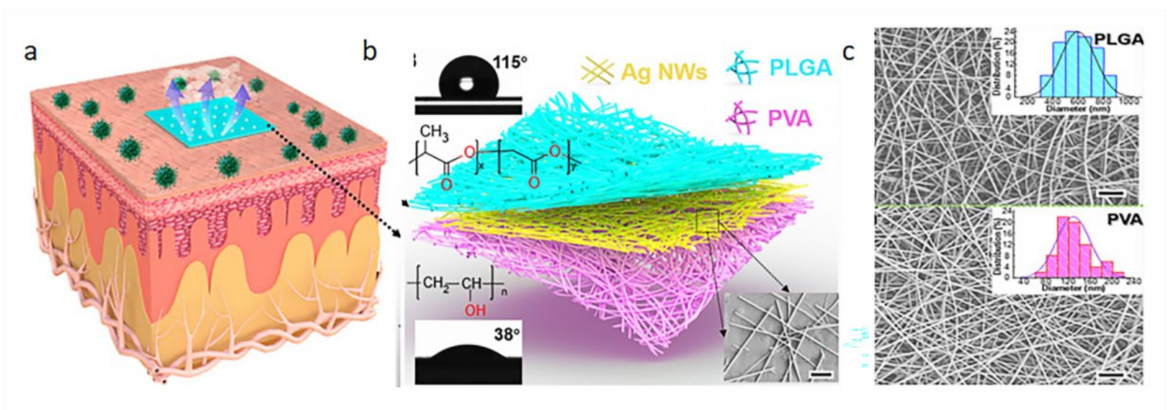 Biosensors 12 00177 g011