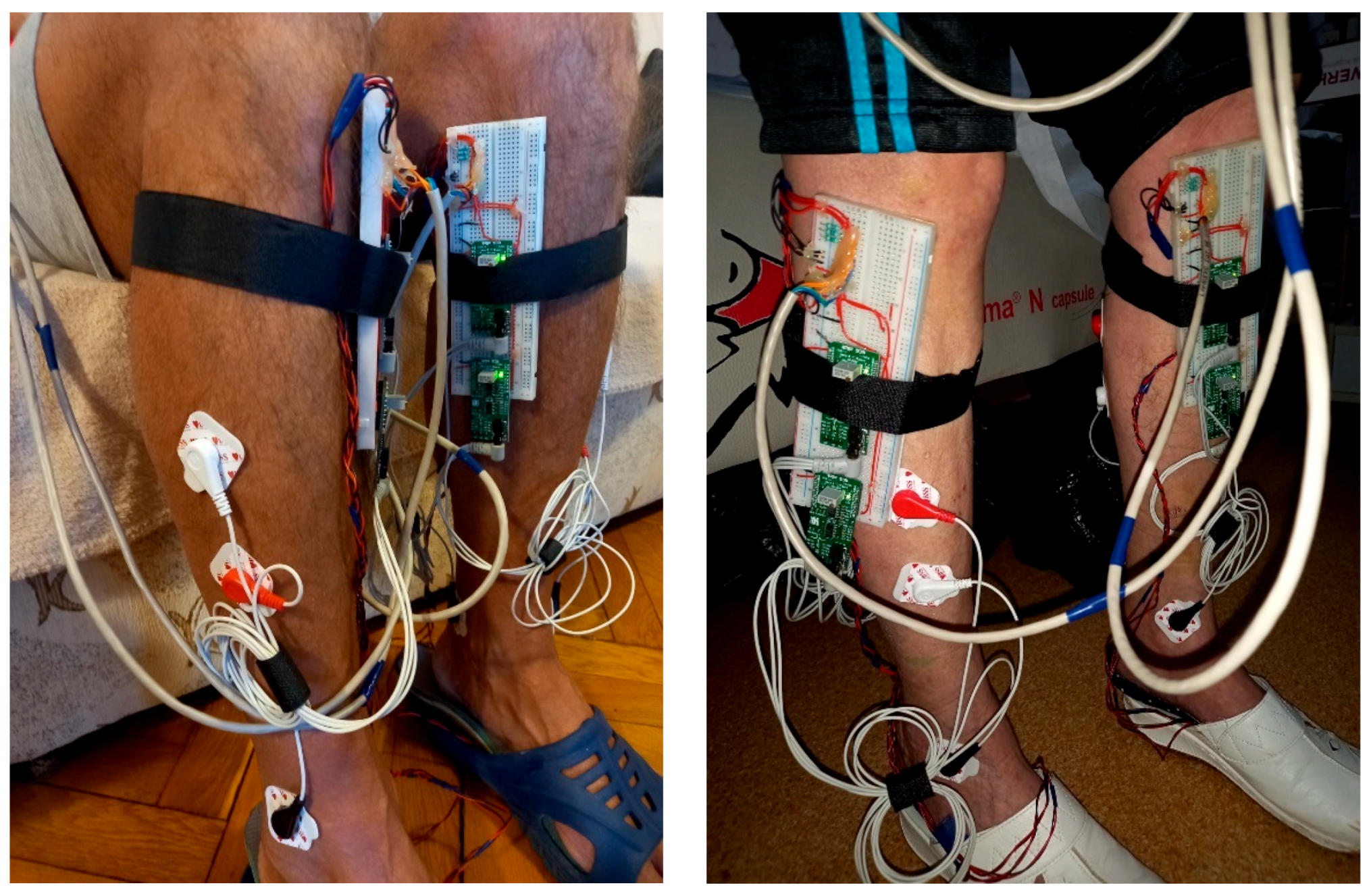 Biosensors 12 00189 g005 550