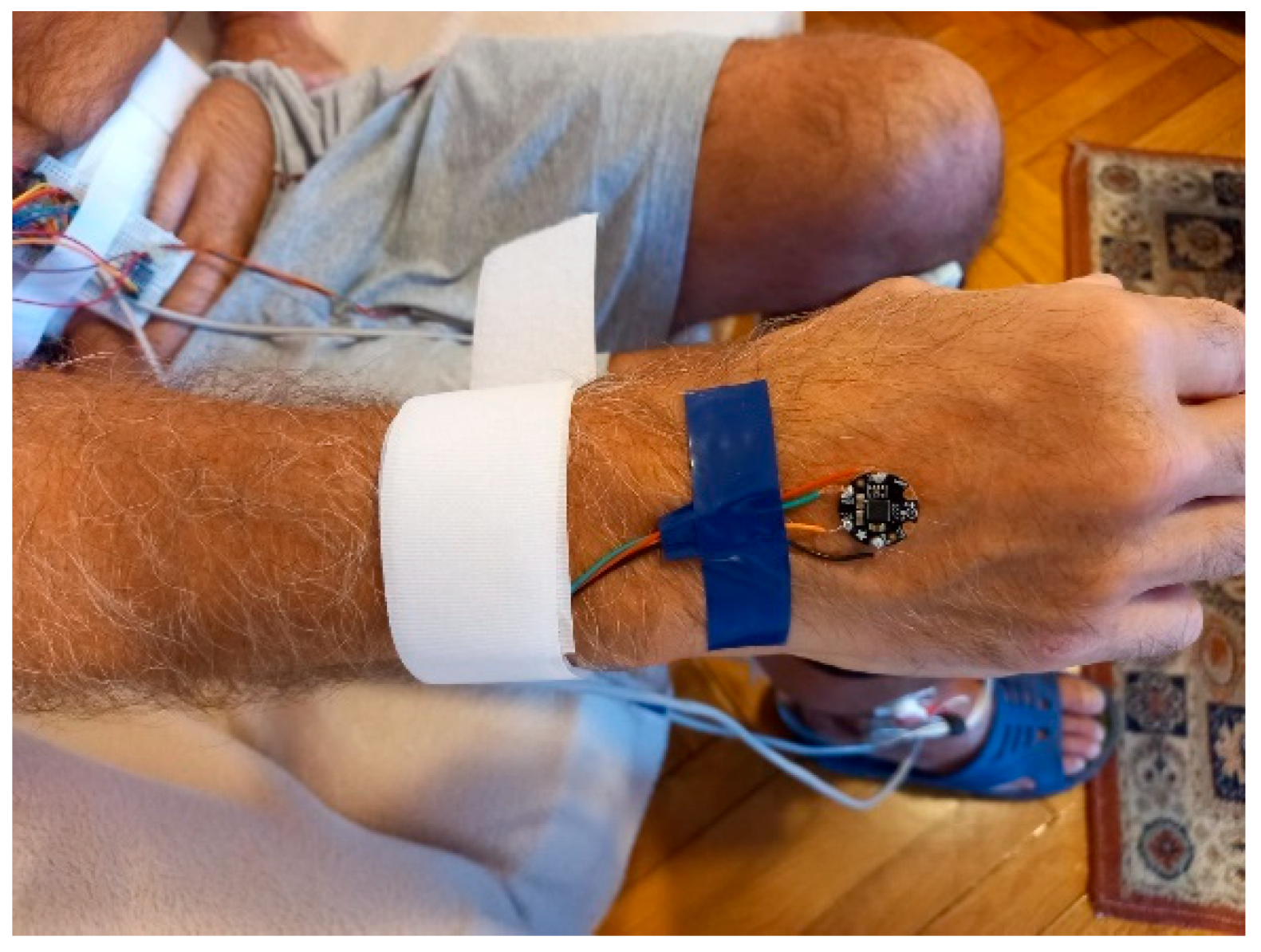 Biosensors 12 00189 g006 550