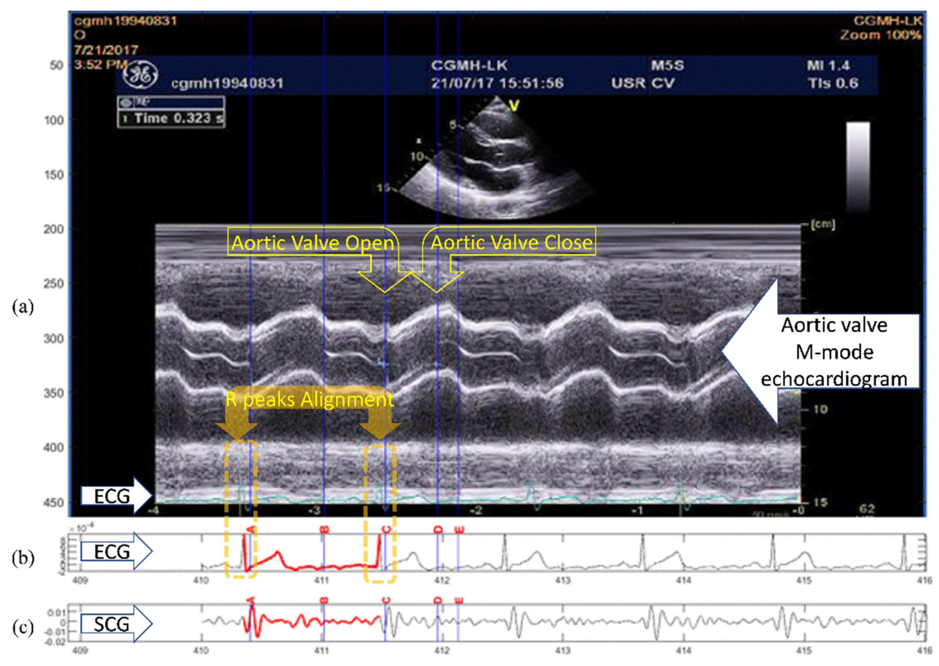 Biosensors 12 00374 g001