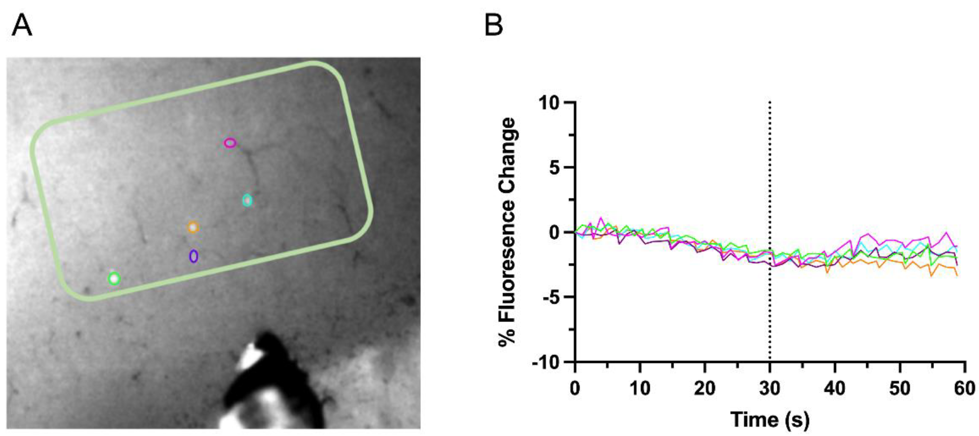 Biosensors 12 00383 g004 Biosensors 12 00383 g004