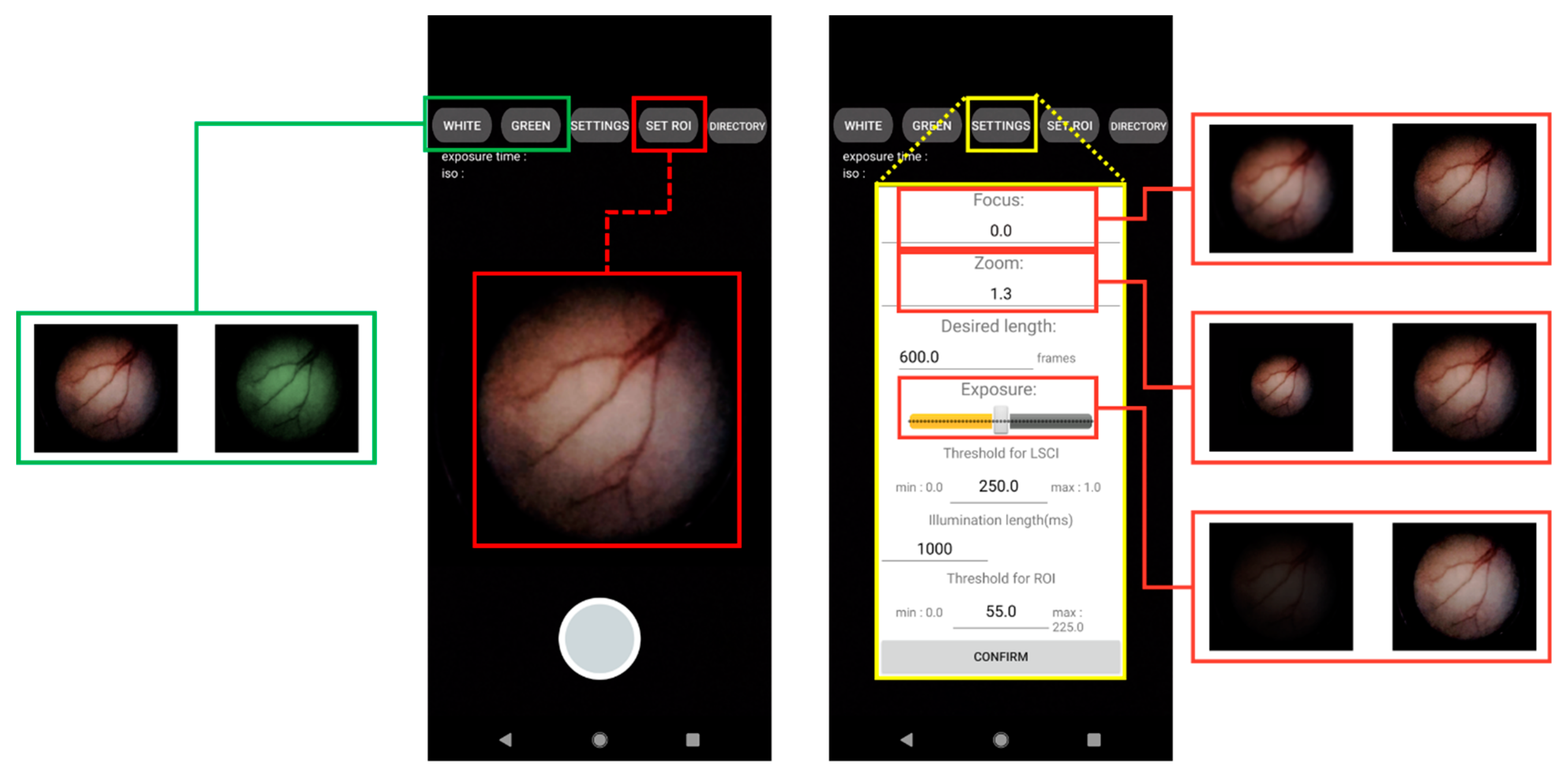 Biosensors 12 00398 g002