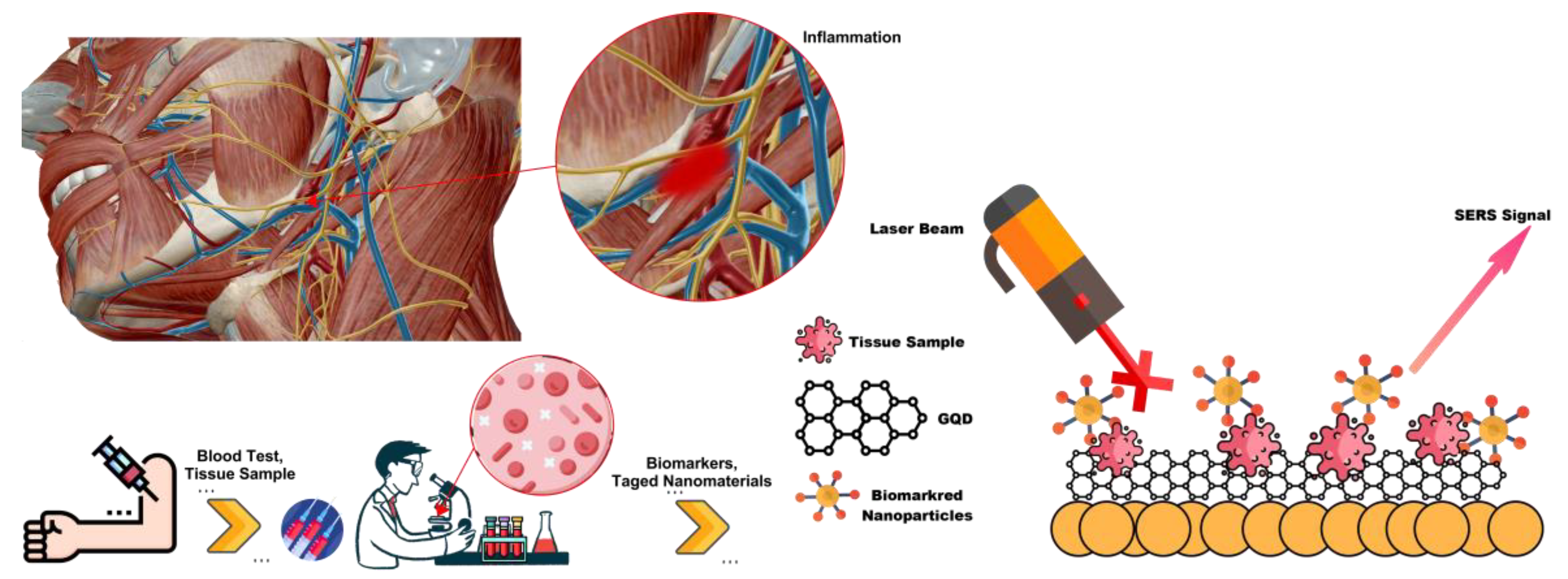 Biosensors 12 00461 g008