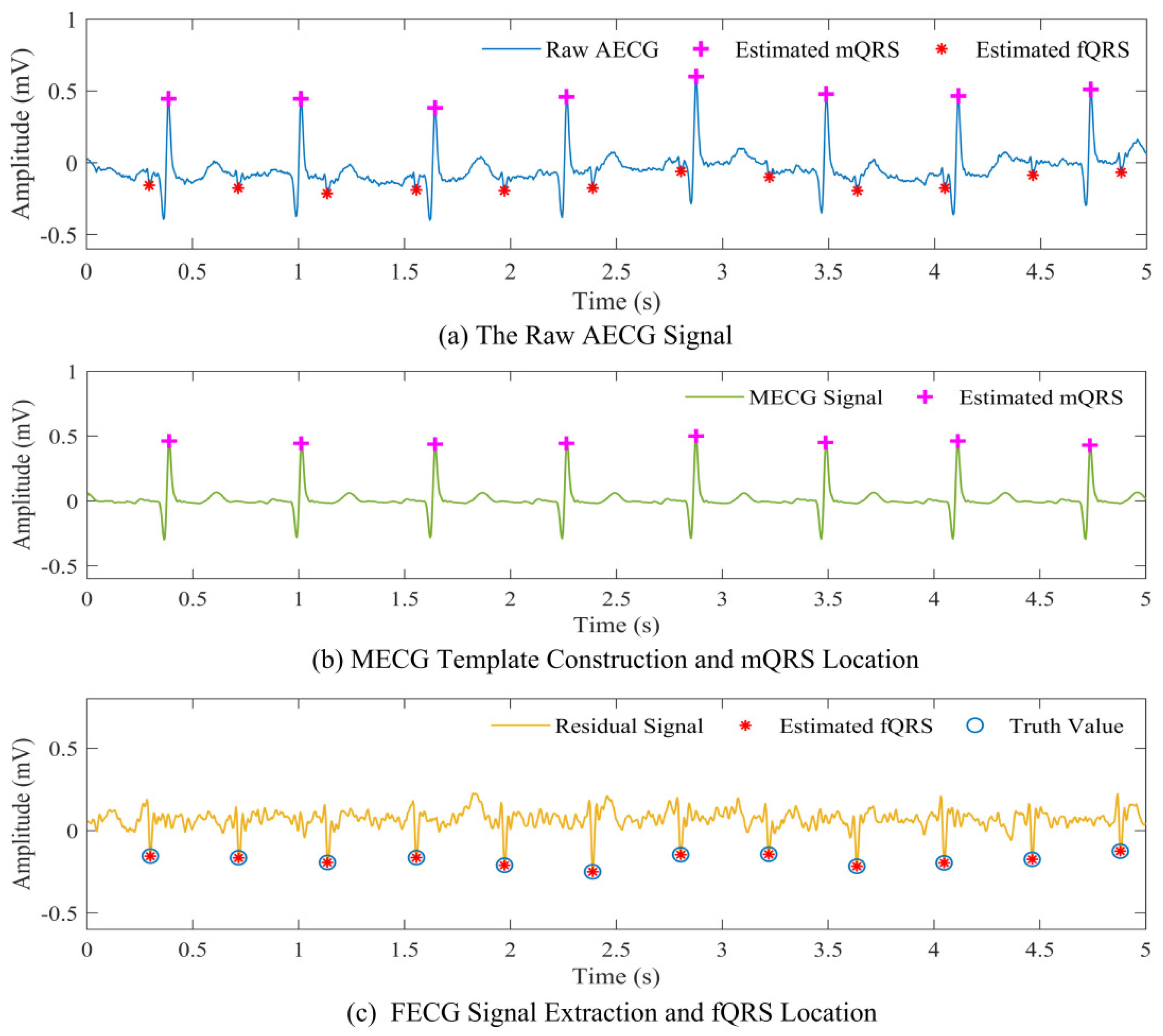 Biosensors Free FullText Wearable Fetal ECG Monitoring System from