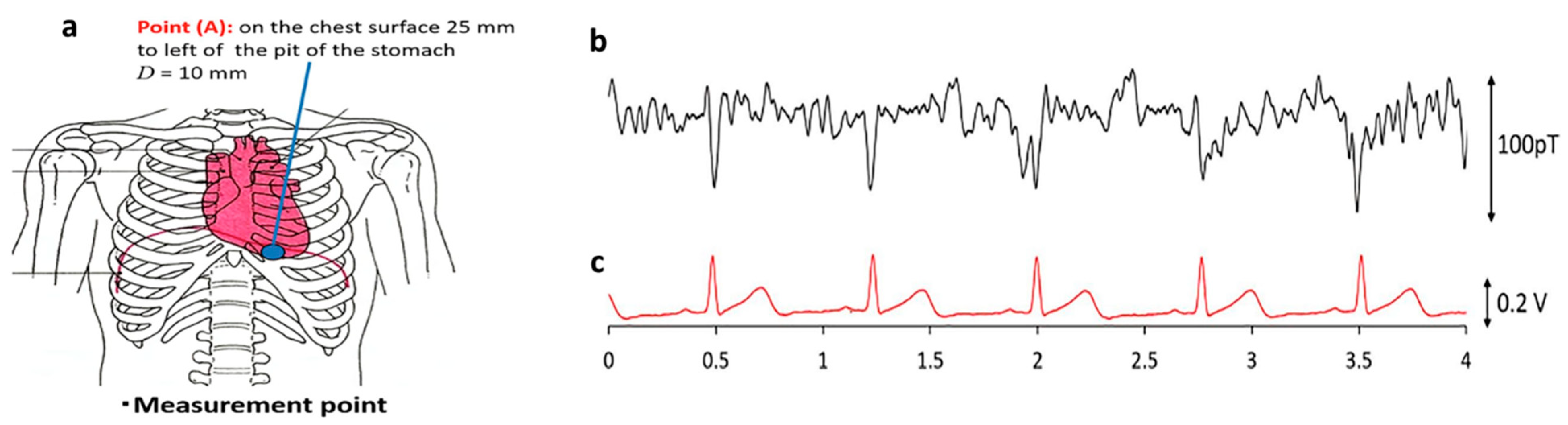 Biosensors 12 00517 g009 Biosensors 12 00517 g009