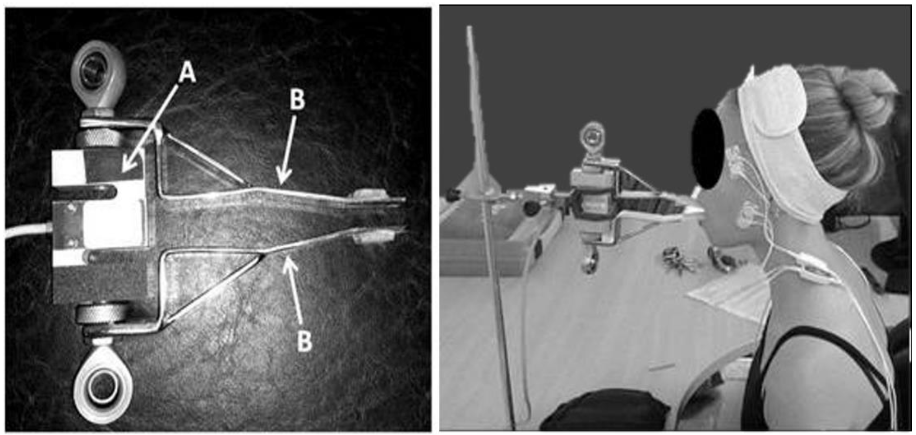 Biosensors 12 00654 g001