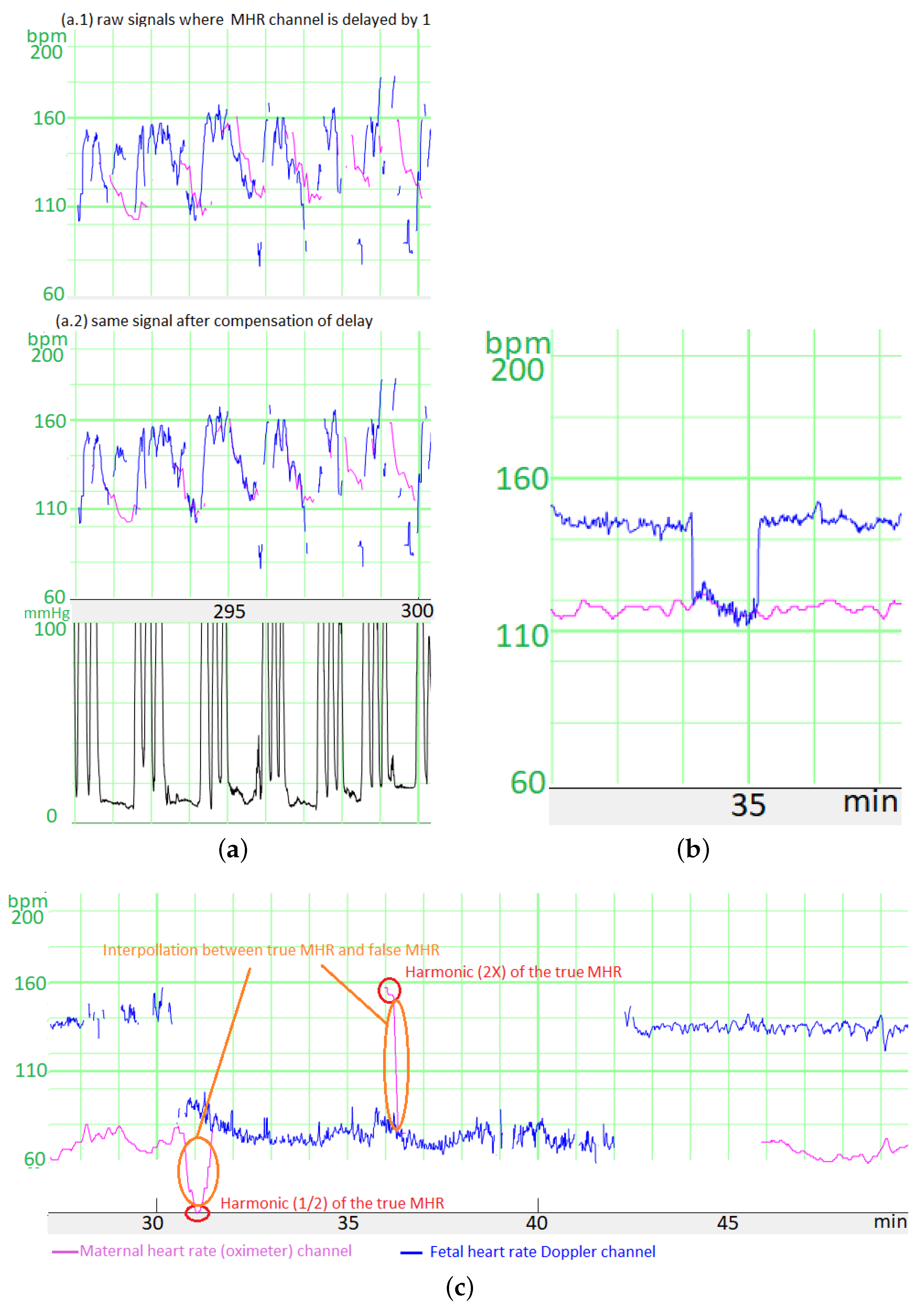 Biosensors 12 00691 g0a1 550