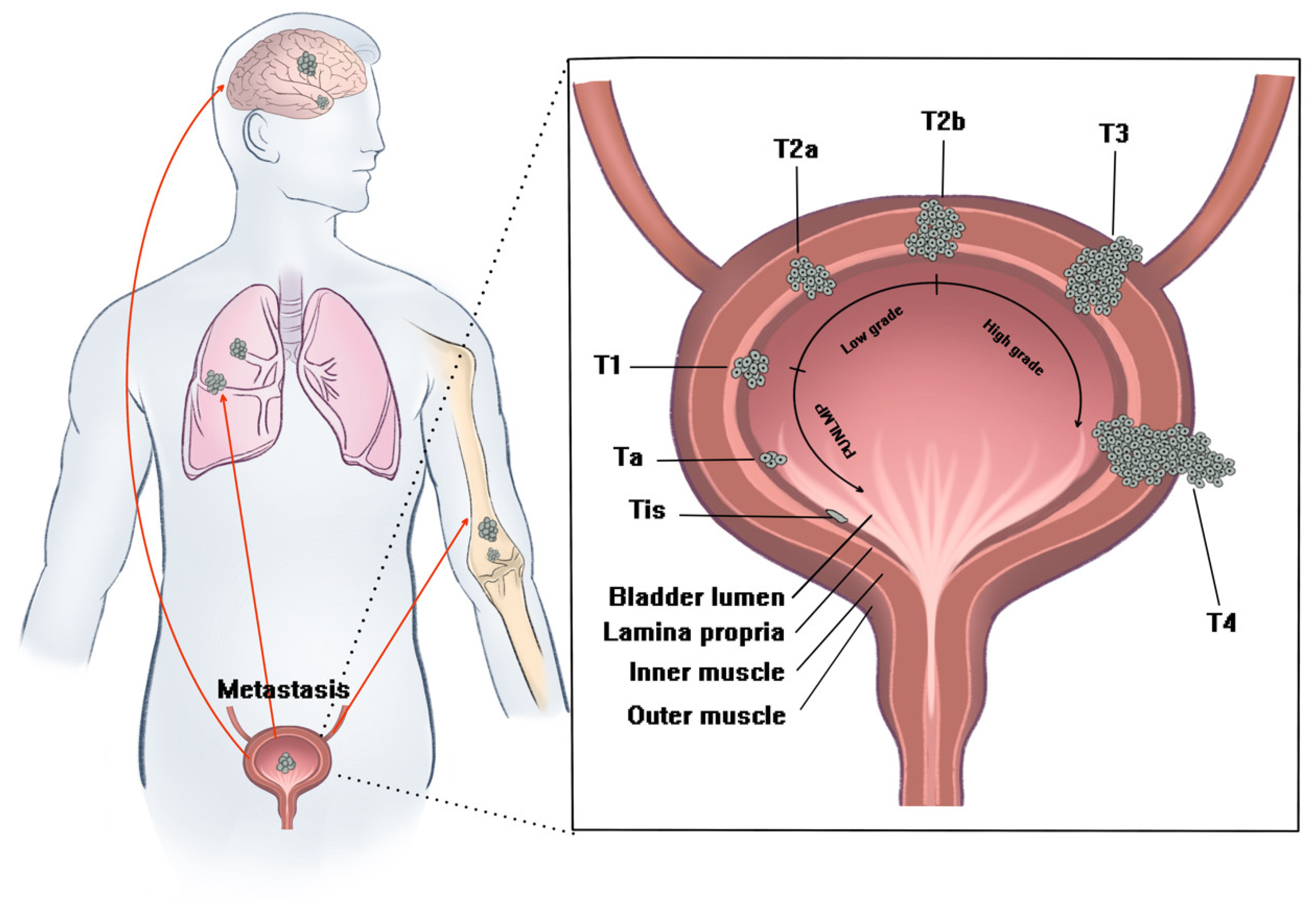 StateoftheArt Advances of Nanomedicine for Diagnosis and Treatment
