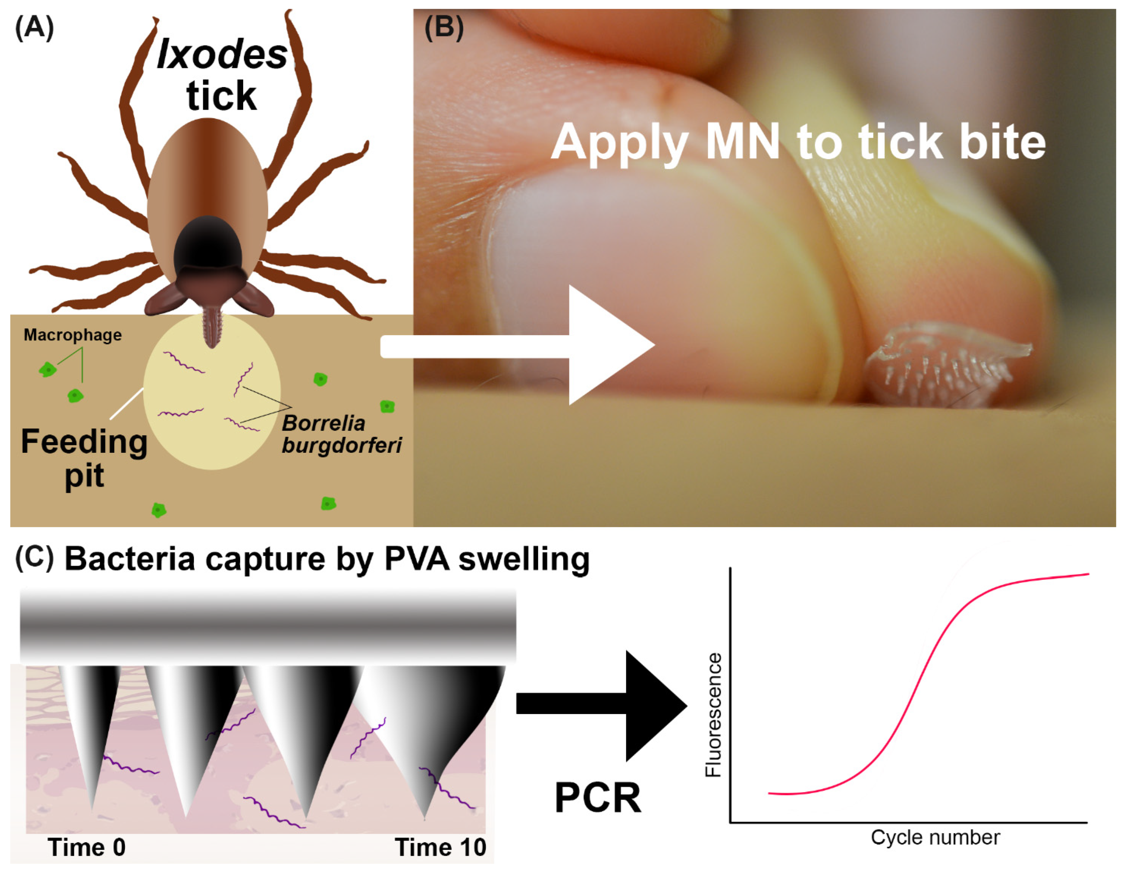 Biosensors | Free Full-Text | Direct Capture and Early Detection ...
