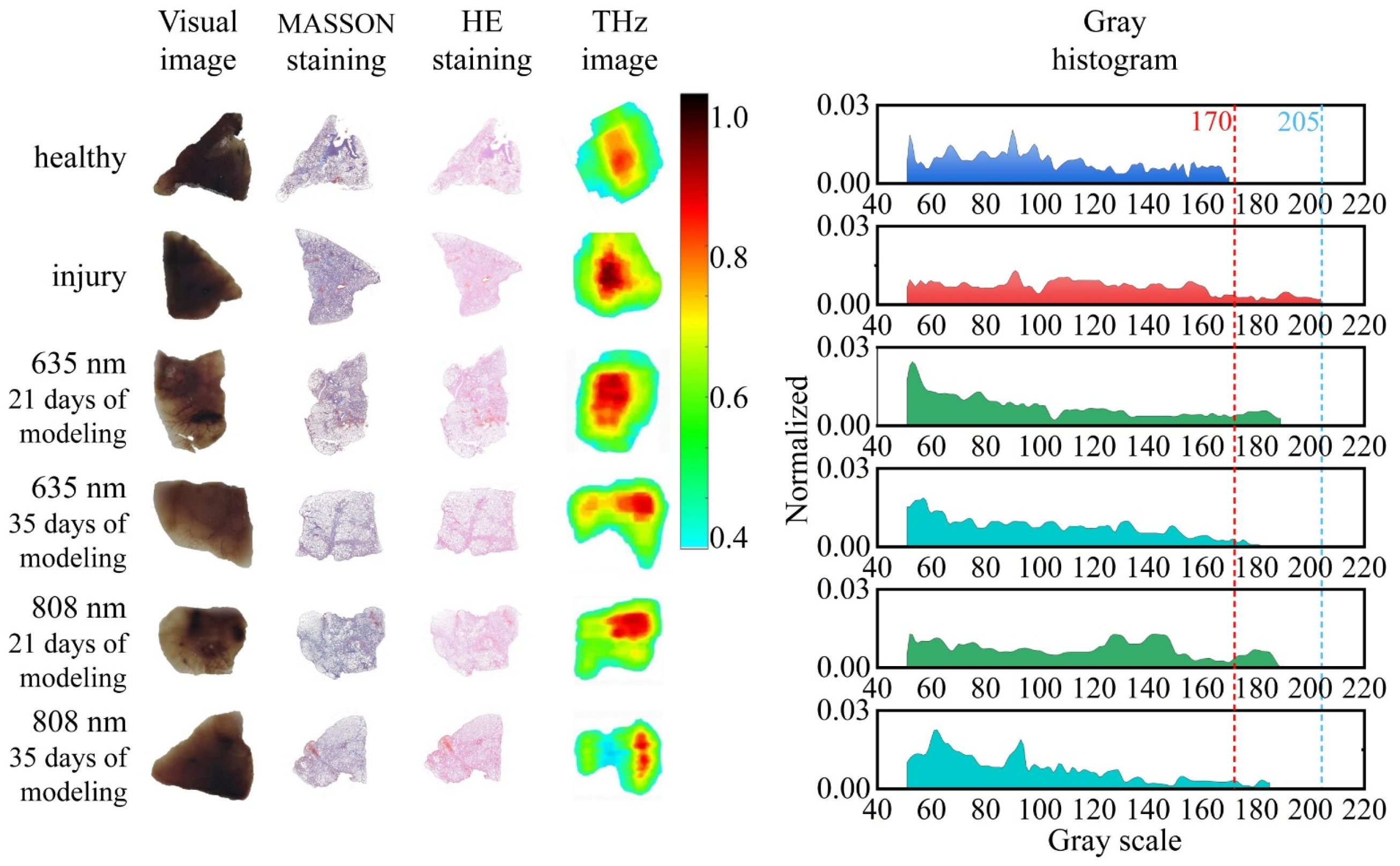 Artificial Intelligence-Assisted Terahertz Imaging for Rapid