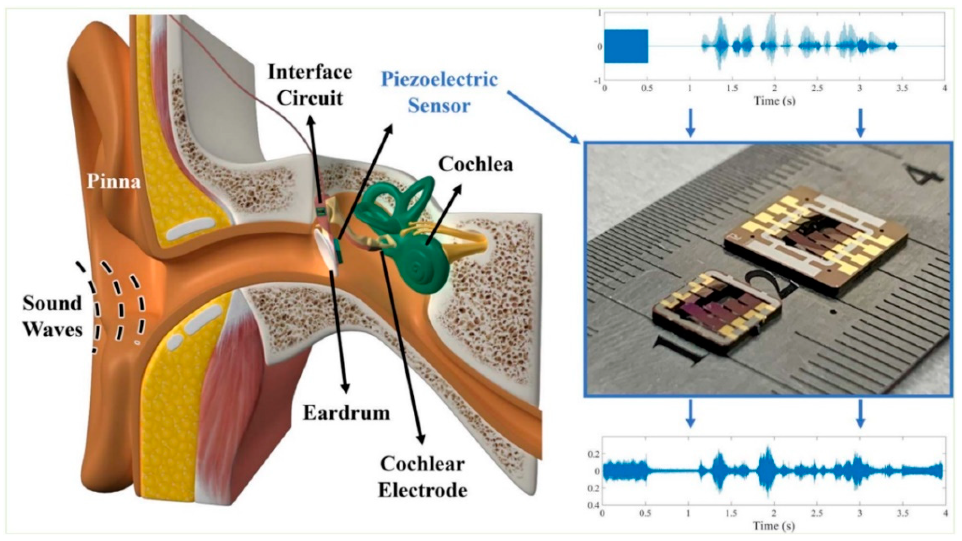 Biosensors 12 00835 g007 Biosensors 12 00835 g007