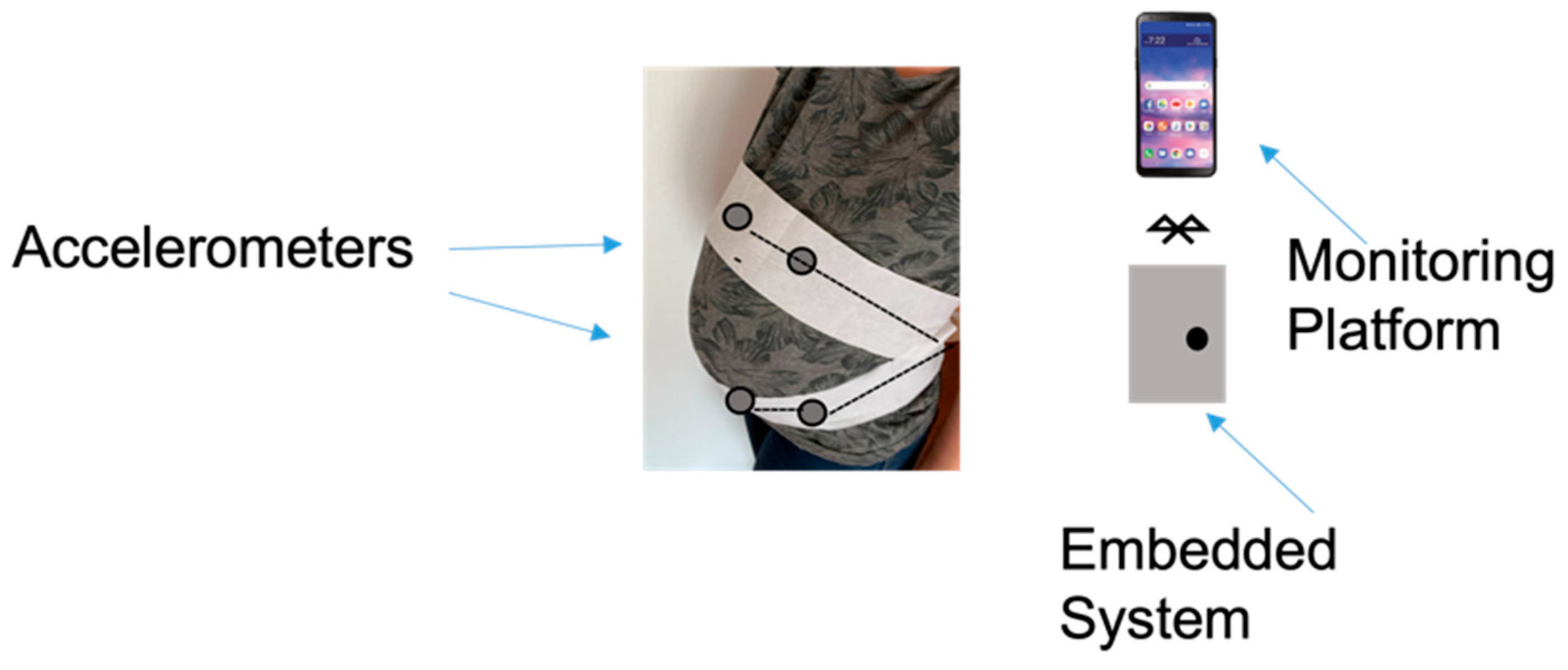 Biosensors 12 00835 g011 Biosensors 12 00835 g011