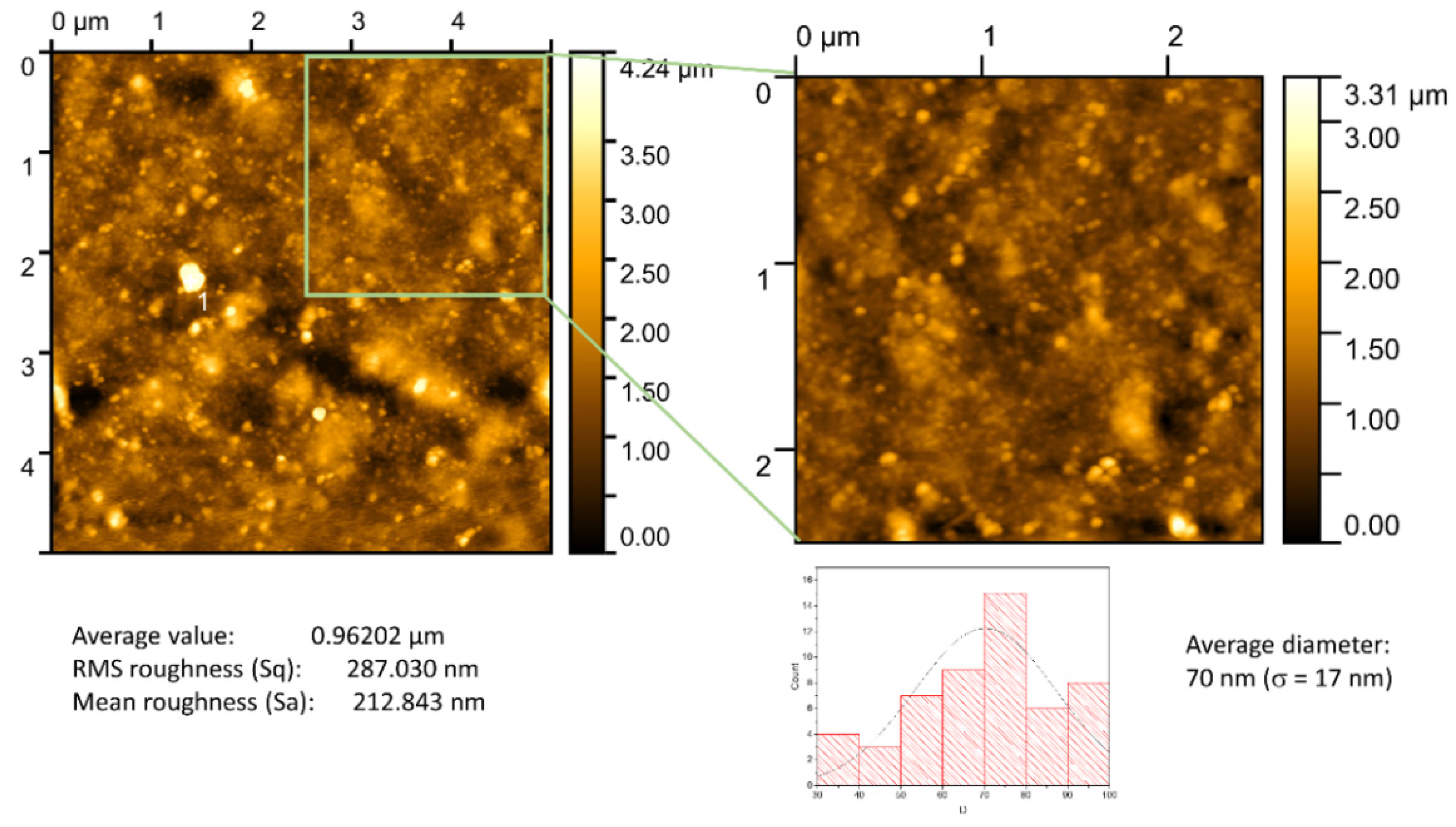 Biosensors 12 00951 g004 Biosensors 12 00951 g004