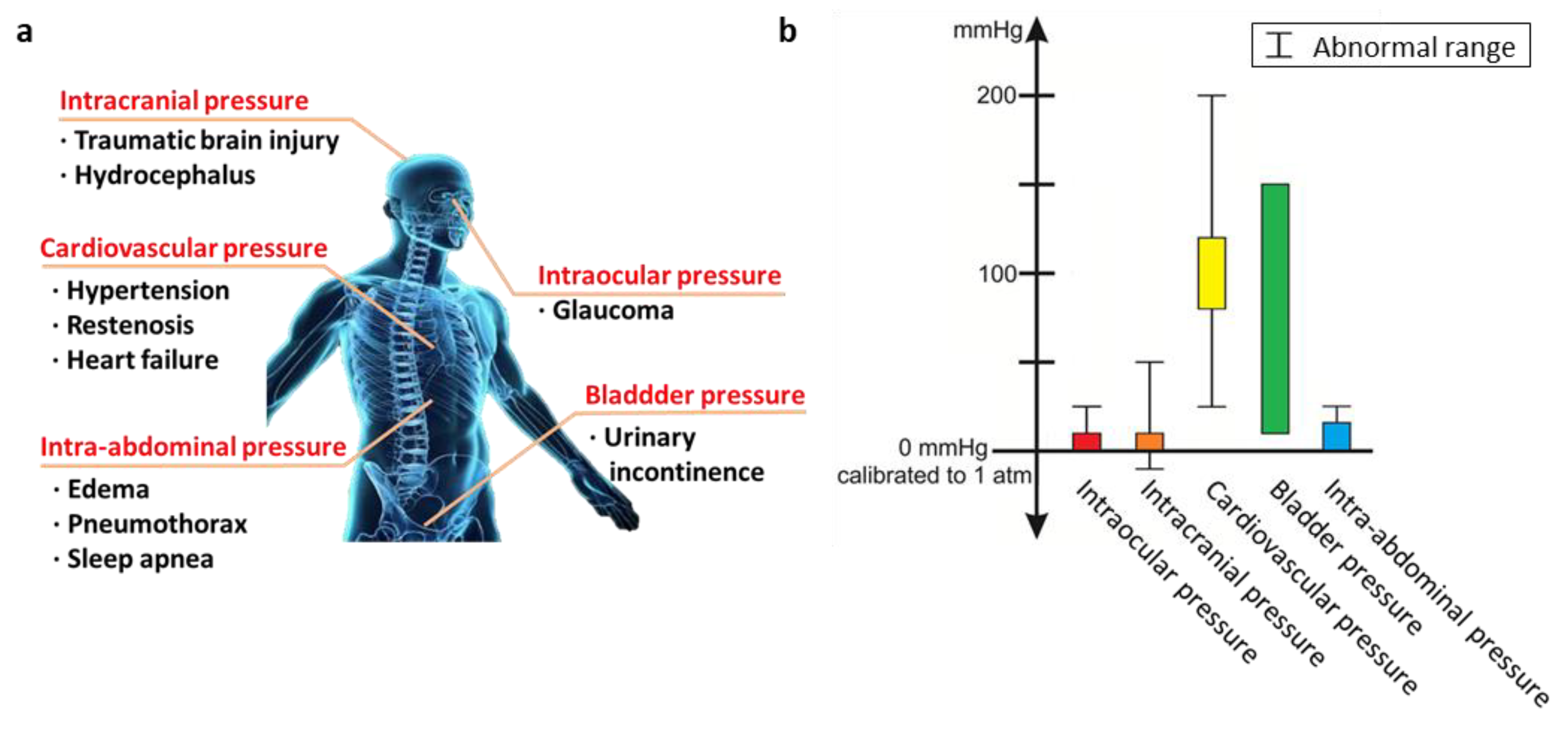 Contact-Free, Passive, Electromagnetic Resonant Sensors for Enclosed  Biomedical Applications: A Perspective on Opportunities and Challenges