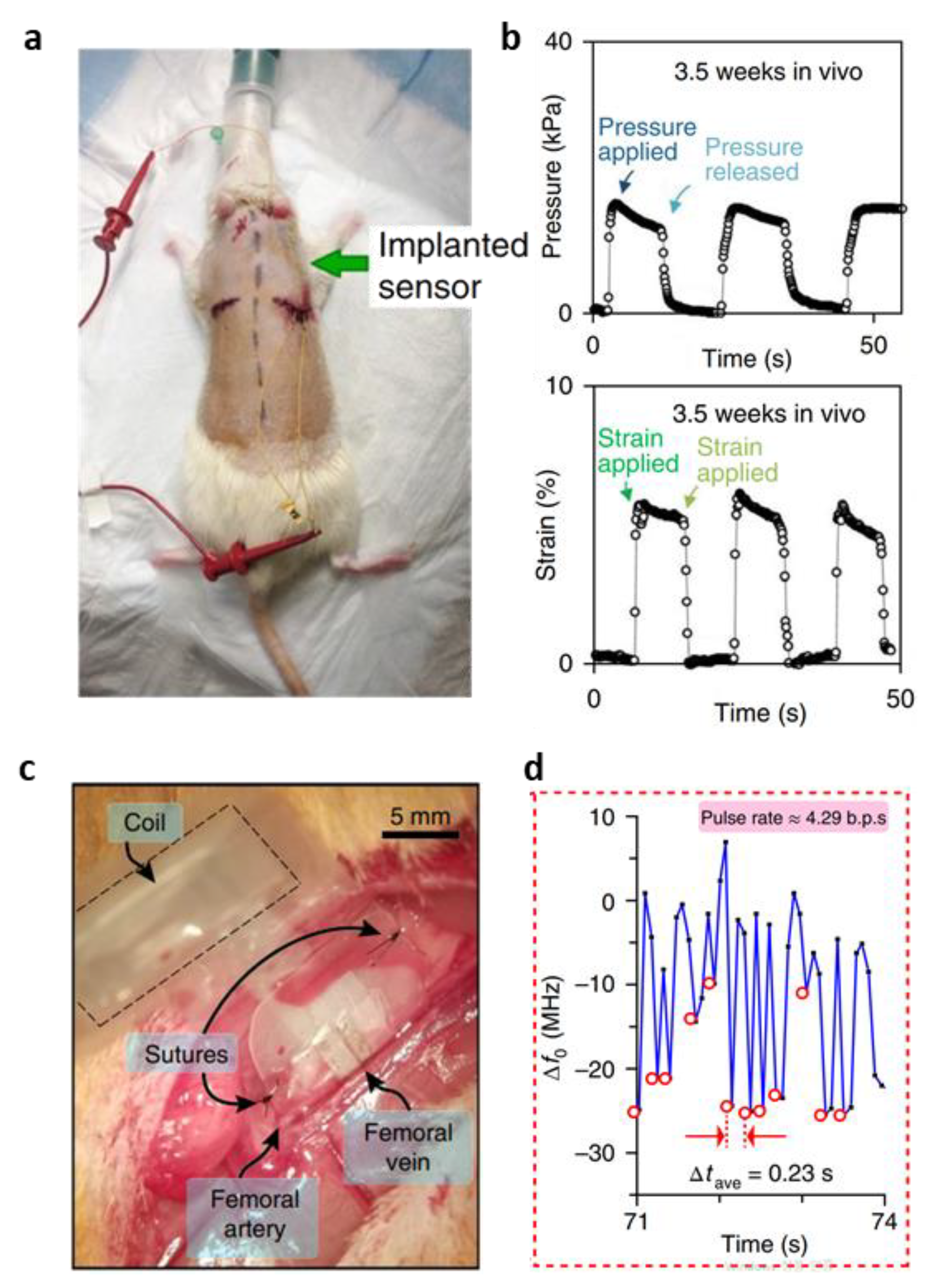 Biosensors 12 00952 g011 Biosensors 12 00952 g011