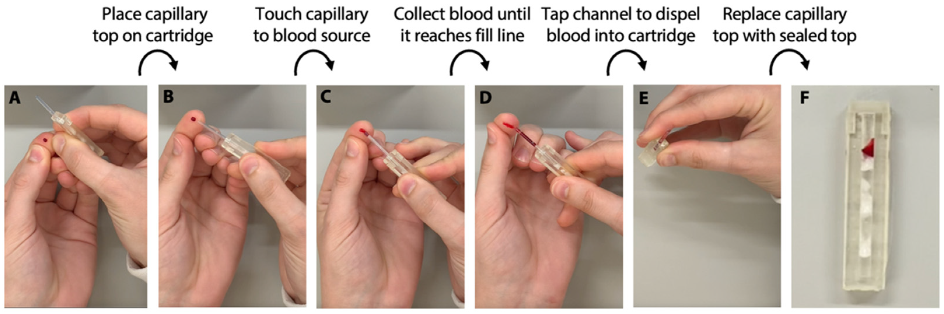 Biosensors 12 01030 g007