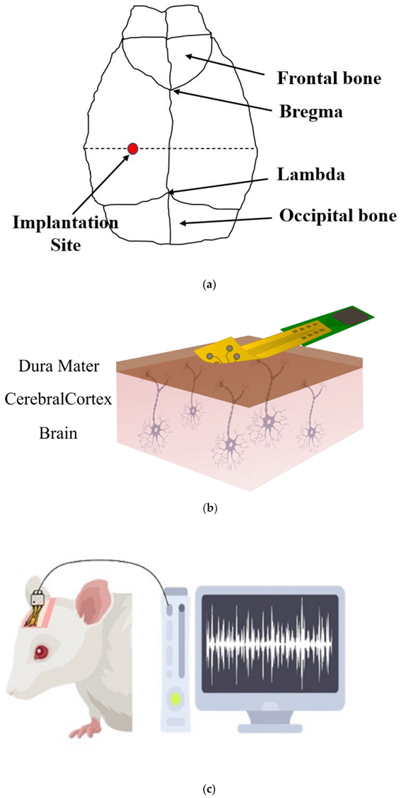 Biosensors 12 01044 g004