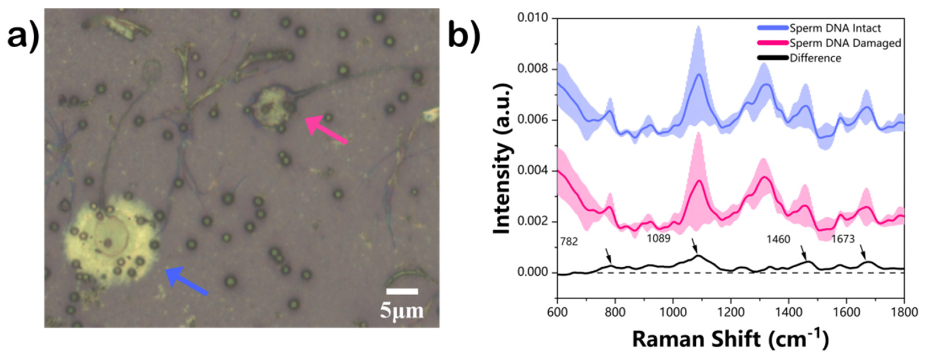 Biosensors 12 01051 g002 Biosensors 12 01051 g002