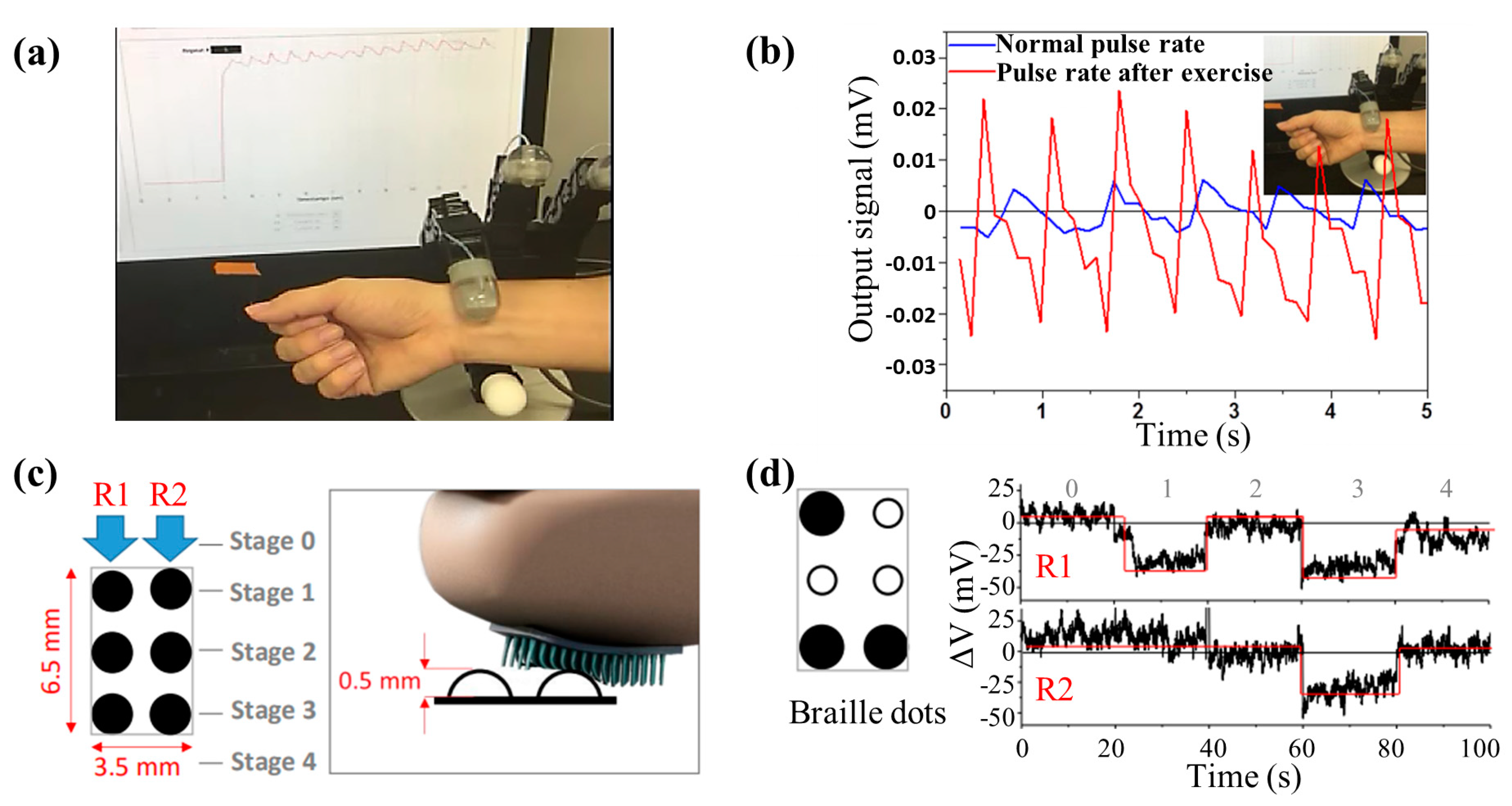 Biosensors 12 01054 g018