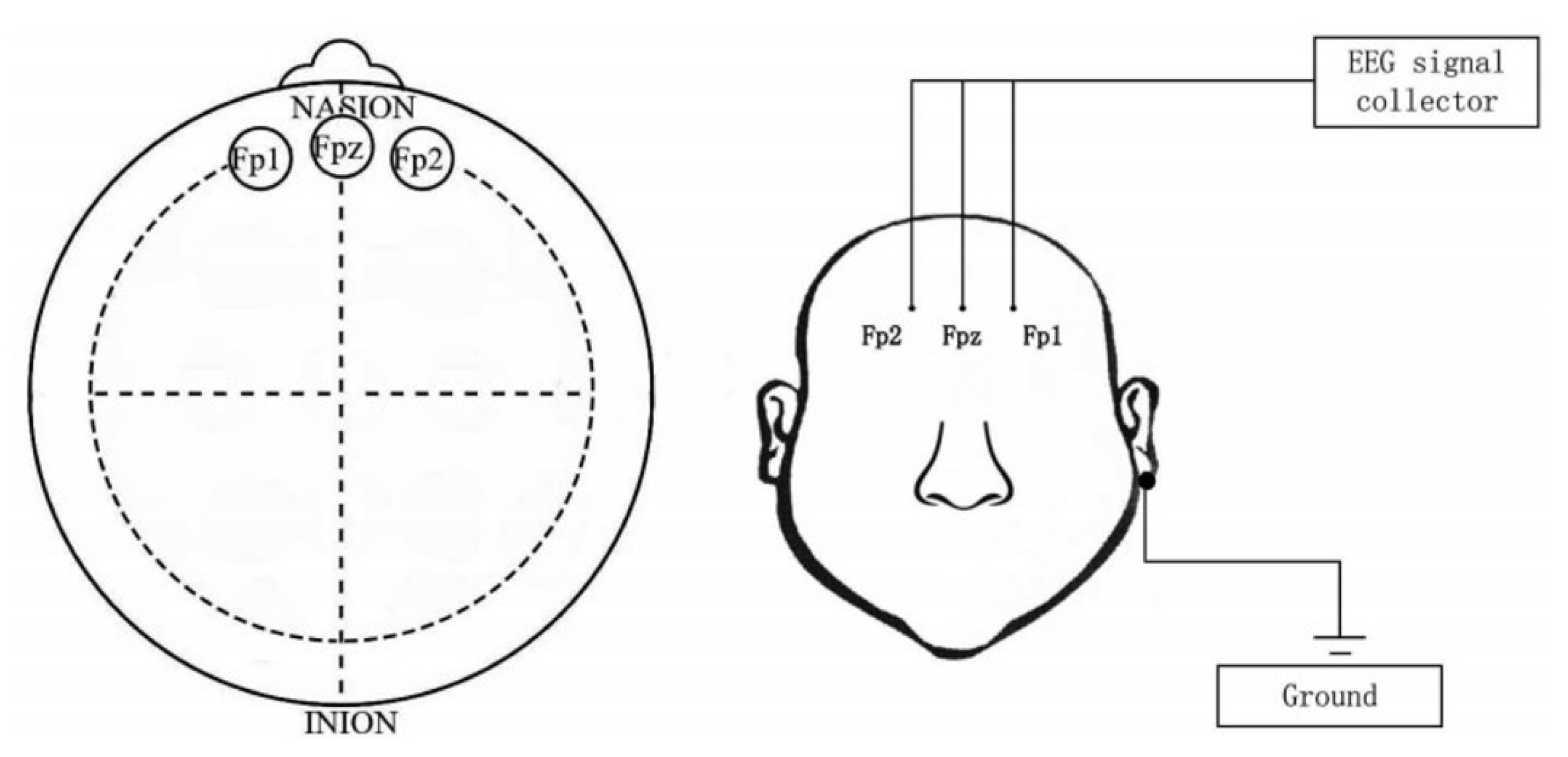 Biosensors 12 01087 g001