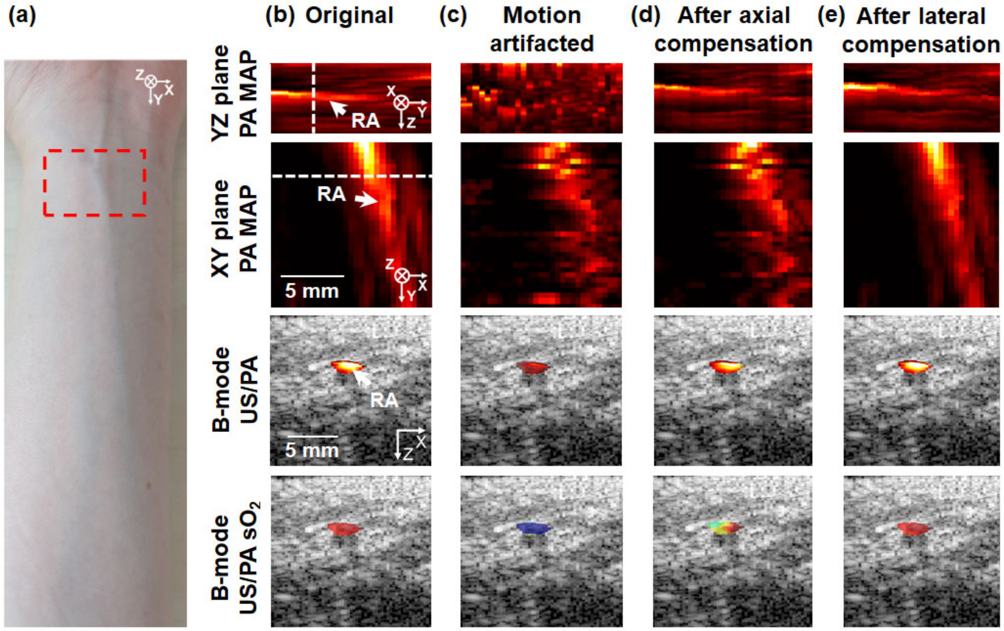 Biosensors 12 01092 g004a Biosensors 12 01092 g004a