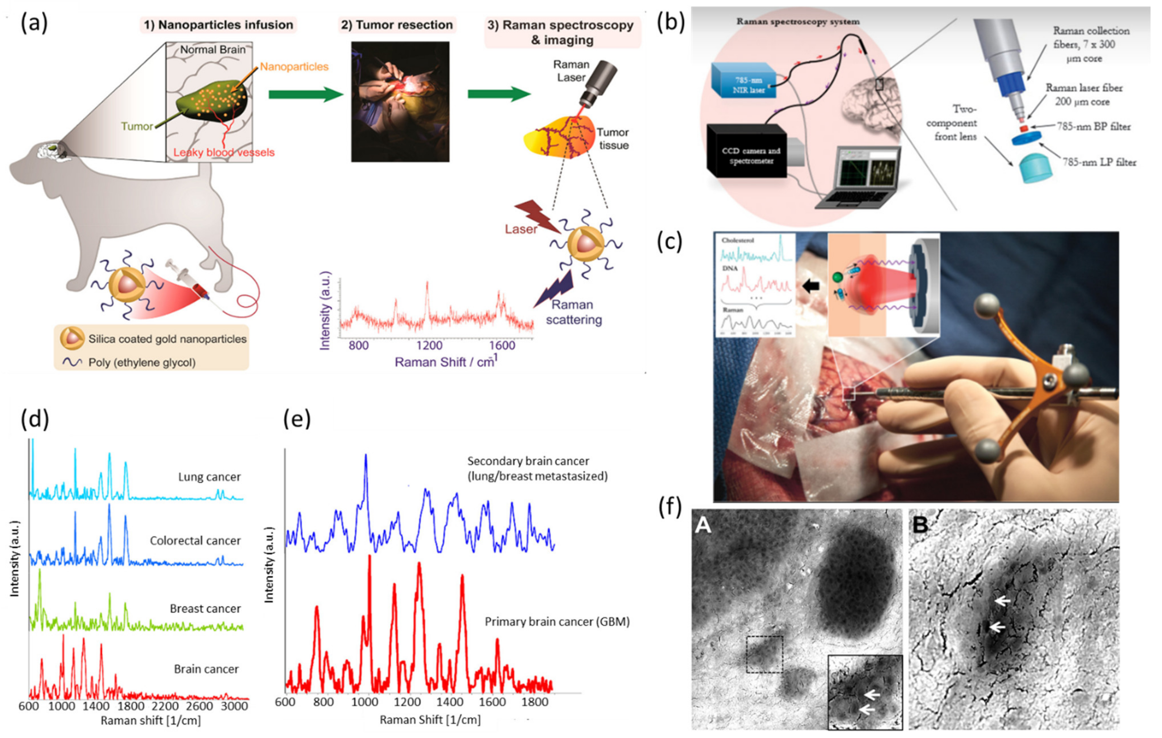 Biosensors 13 00027 g006 Biosensors 13 00027 g006