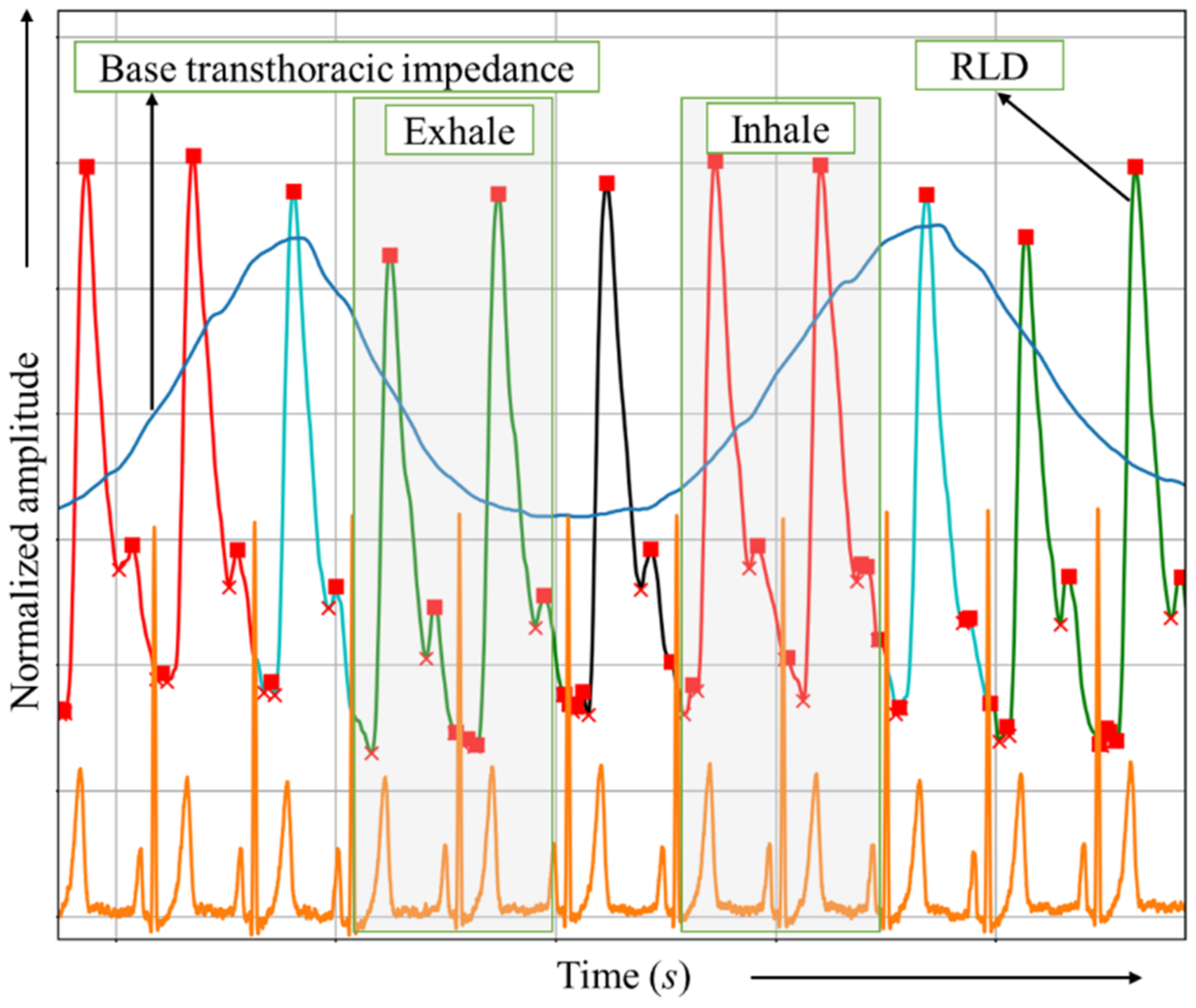 Biosensors 13 00096 g004 Biosensors 13 00096 g004
