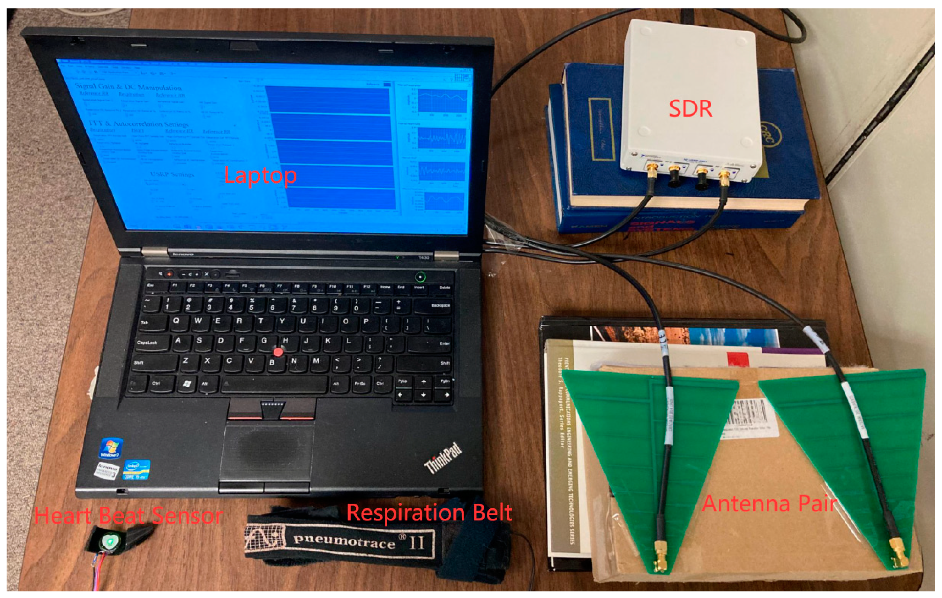 Biosensors 13 00191 g002