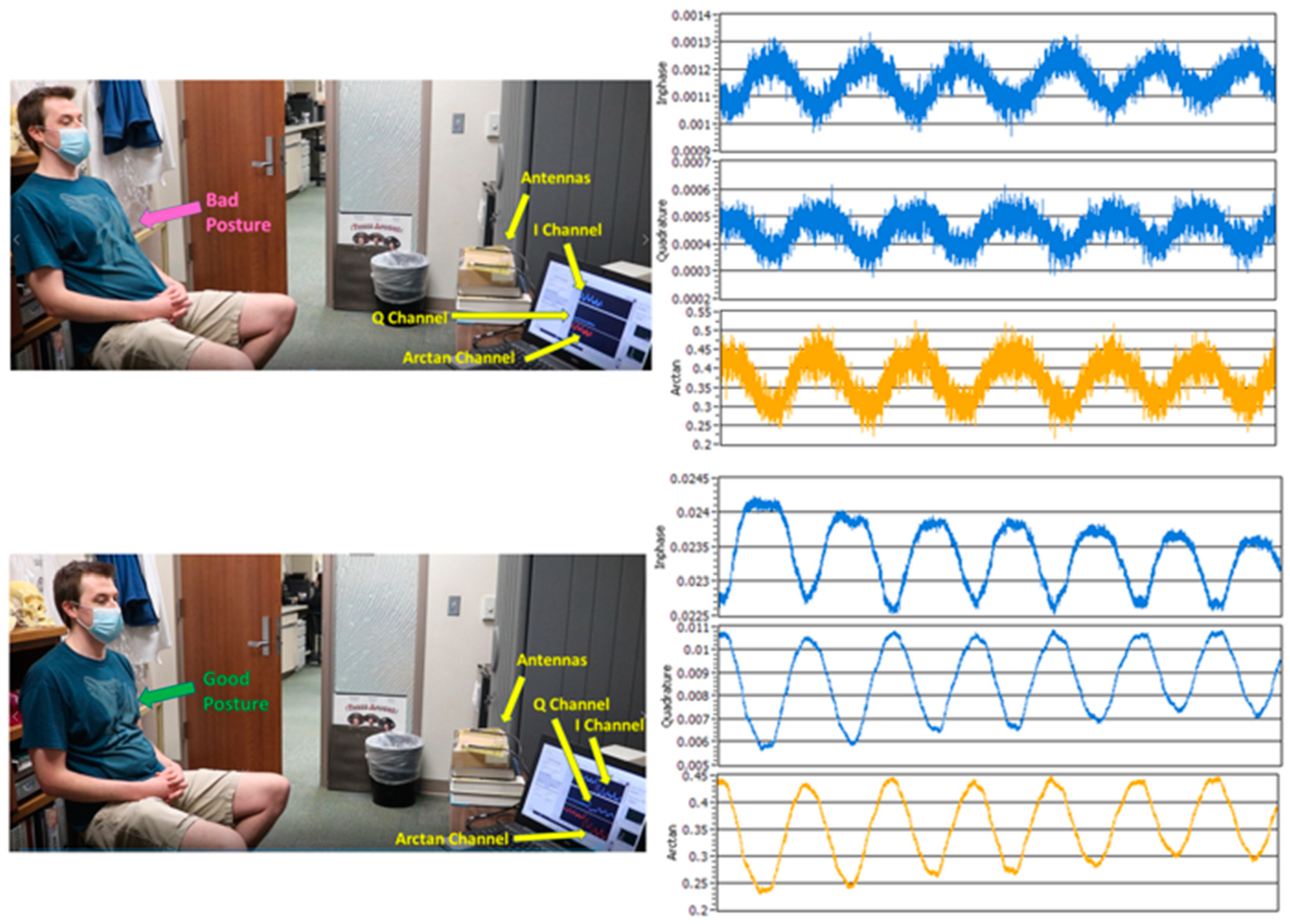 Biosensors 13 00191 g006