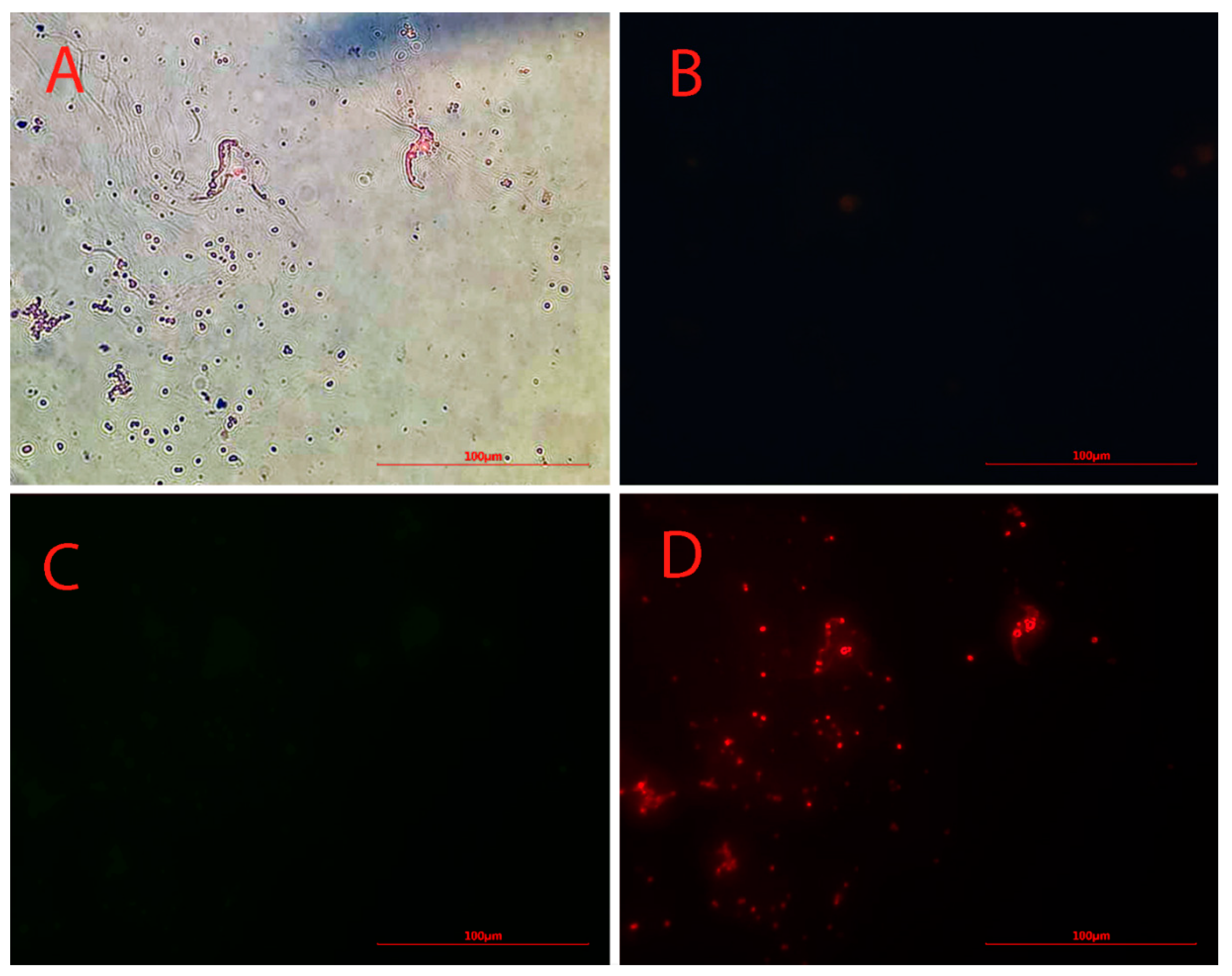 Biosensors 13 00268 g002