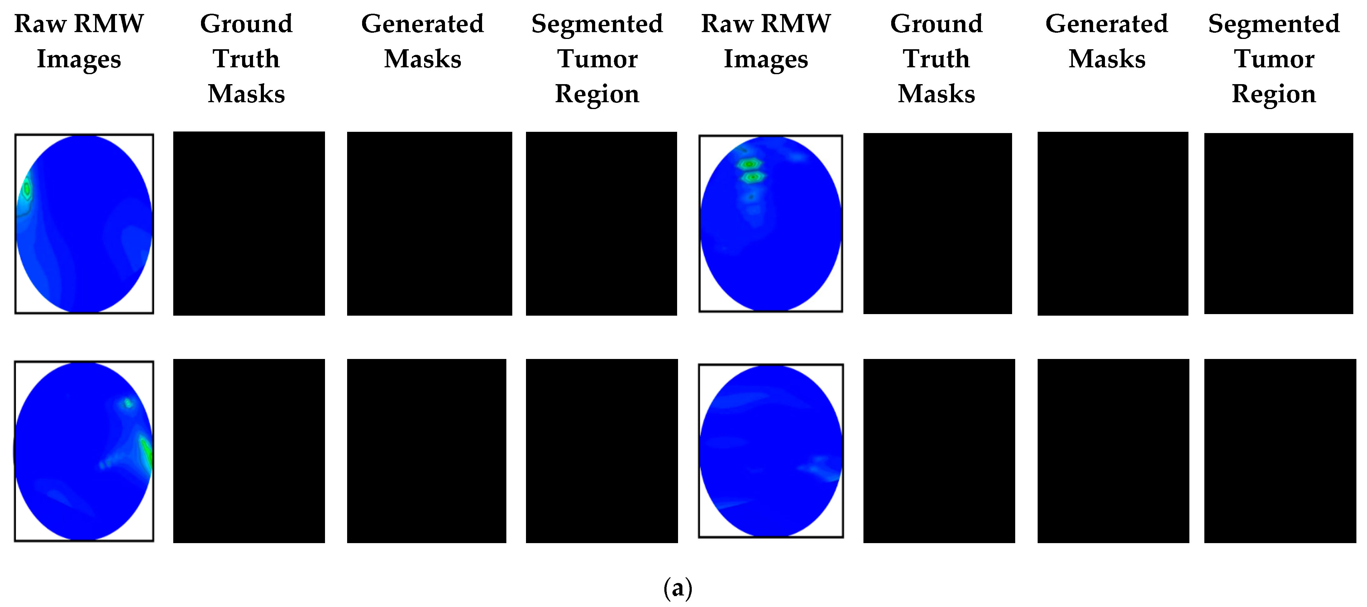 Biosensors 13 00302 g014a Biosensors 13 00302 g014a