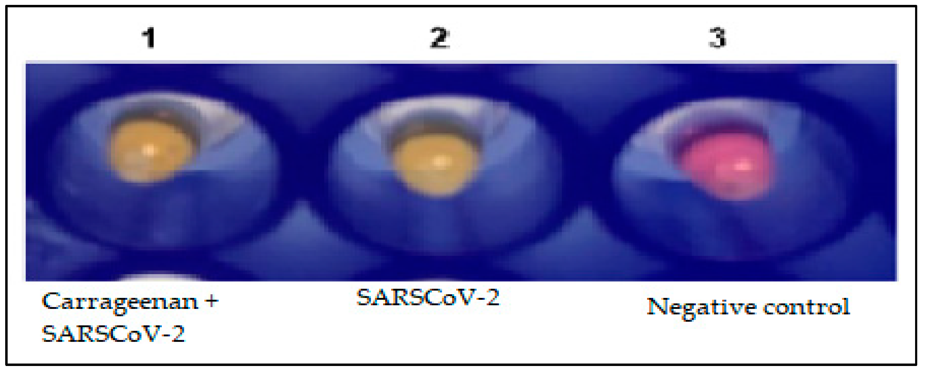 Biosensors 13 00378 g010 Biosensors 13 00378 g010