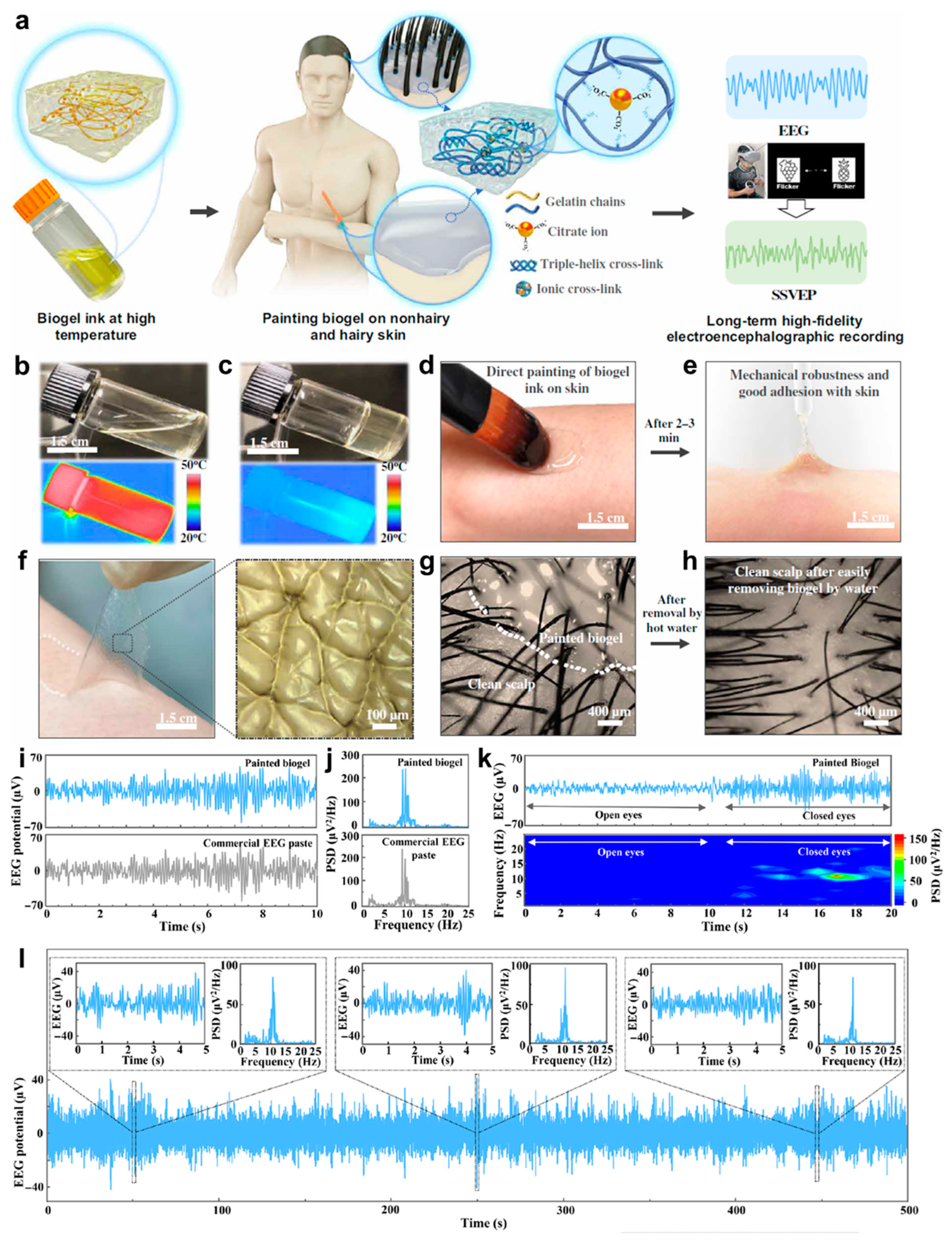 Biosensors 13 00393 g005 Biosensors 13 00393 g005